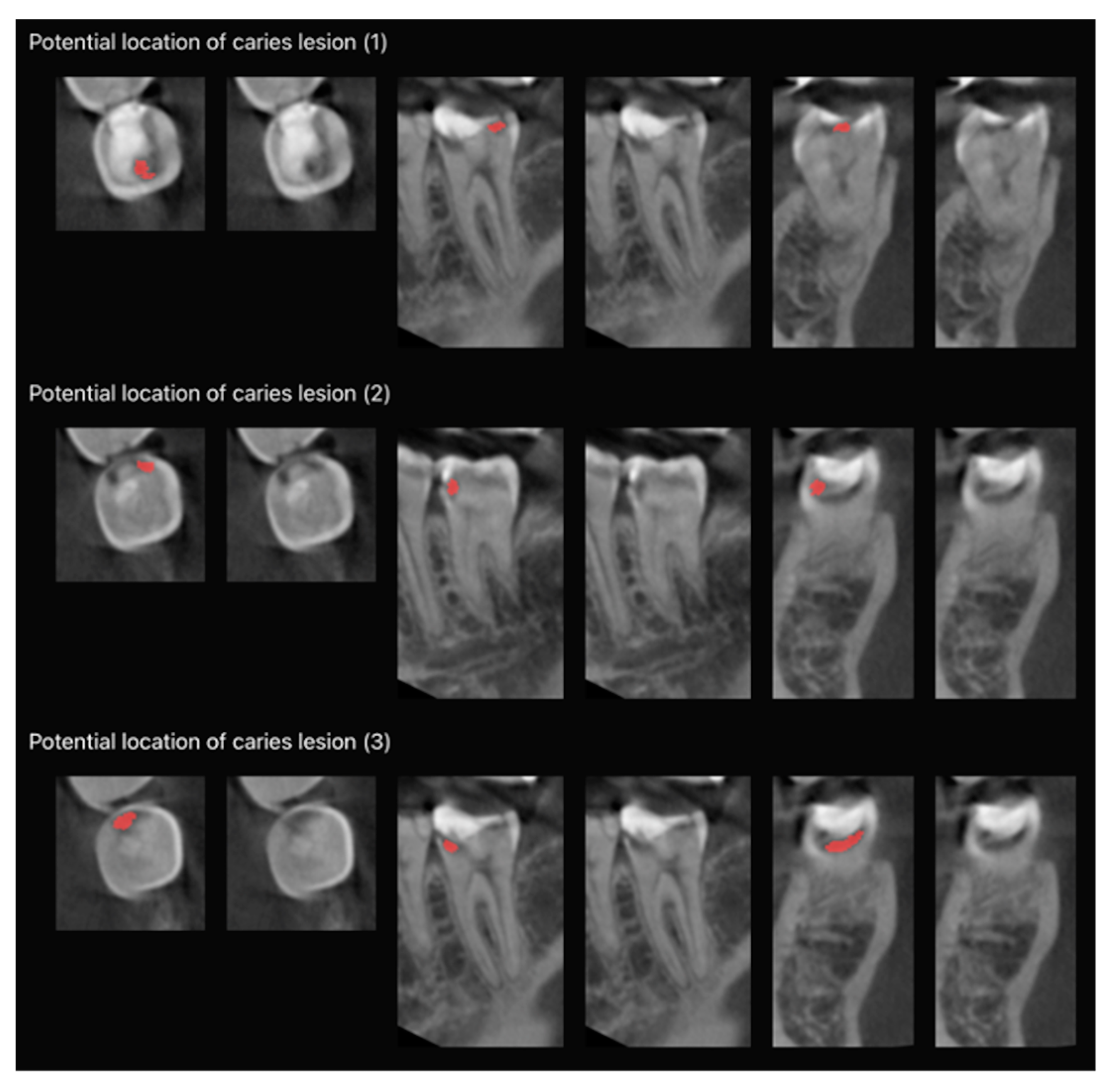 Diagnostics 13 03471 g004