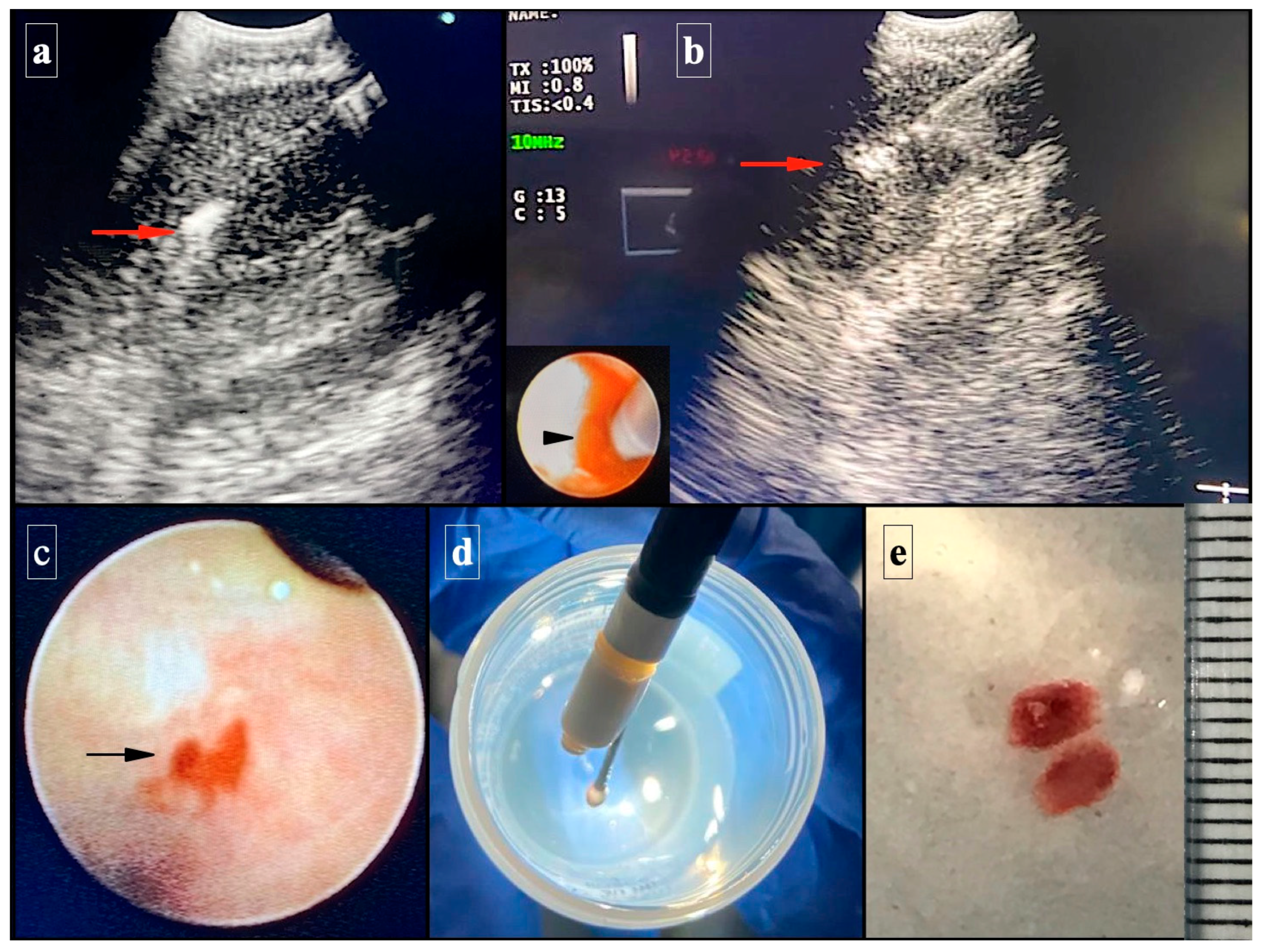 Diagnostics 13 03476 g001