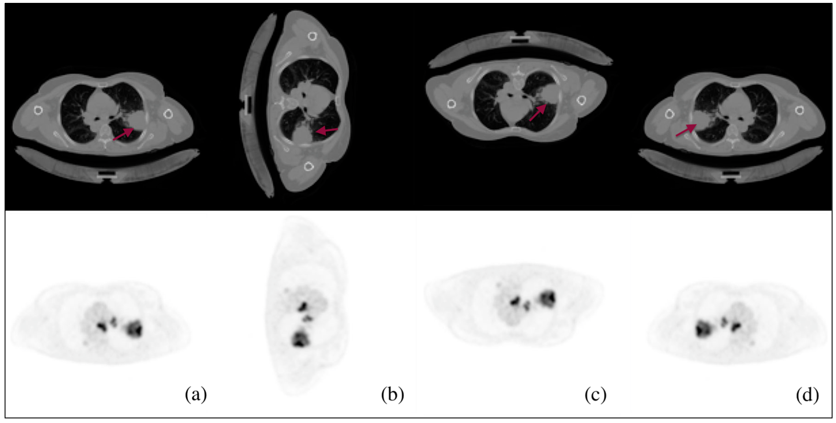 Diagnostics 13 03481 g002
