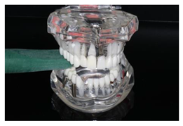 Diagnostics 13 03498 i007