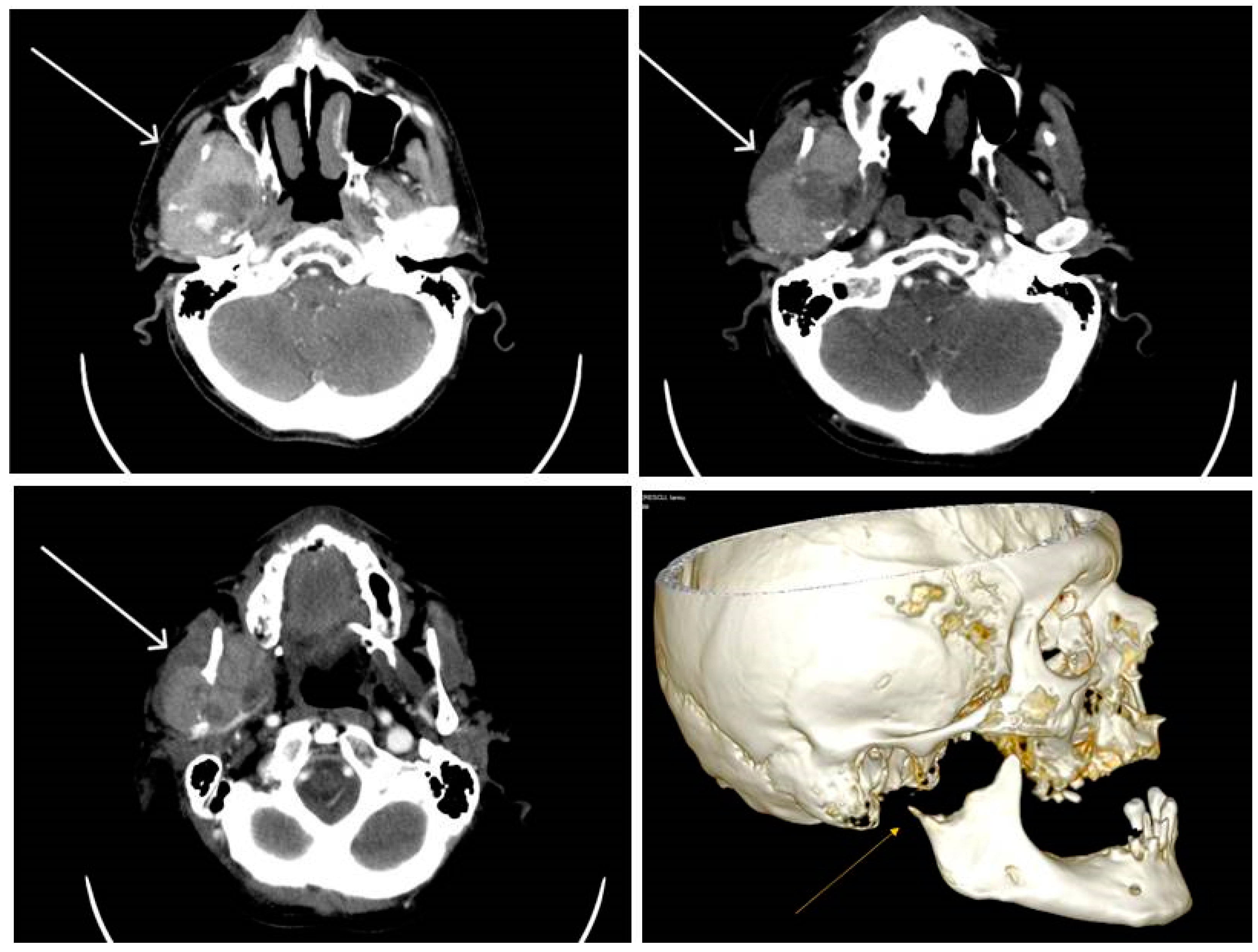 Diagnostics 13 03513 g007