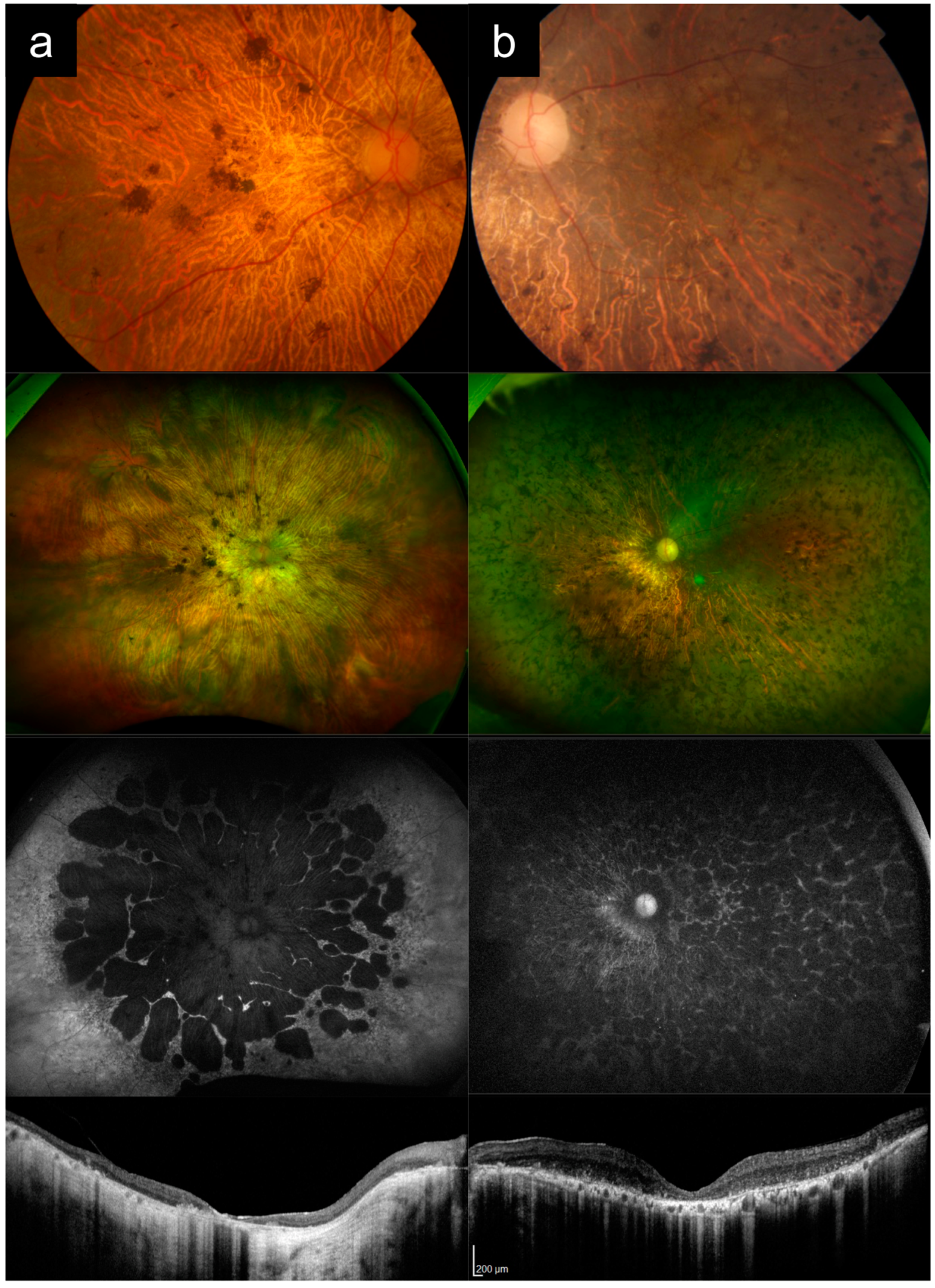 Diagnostics 13 03530 g005