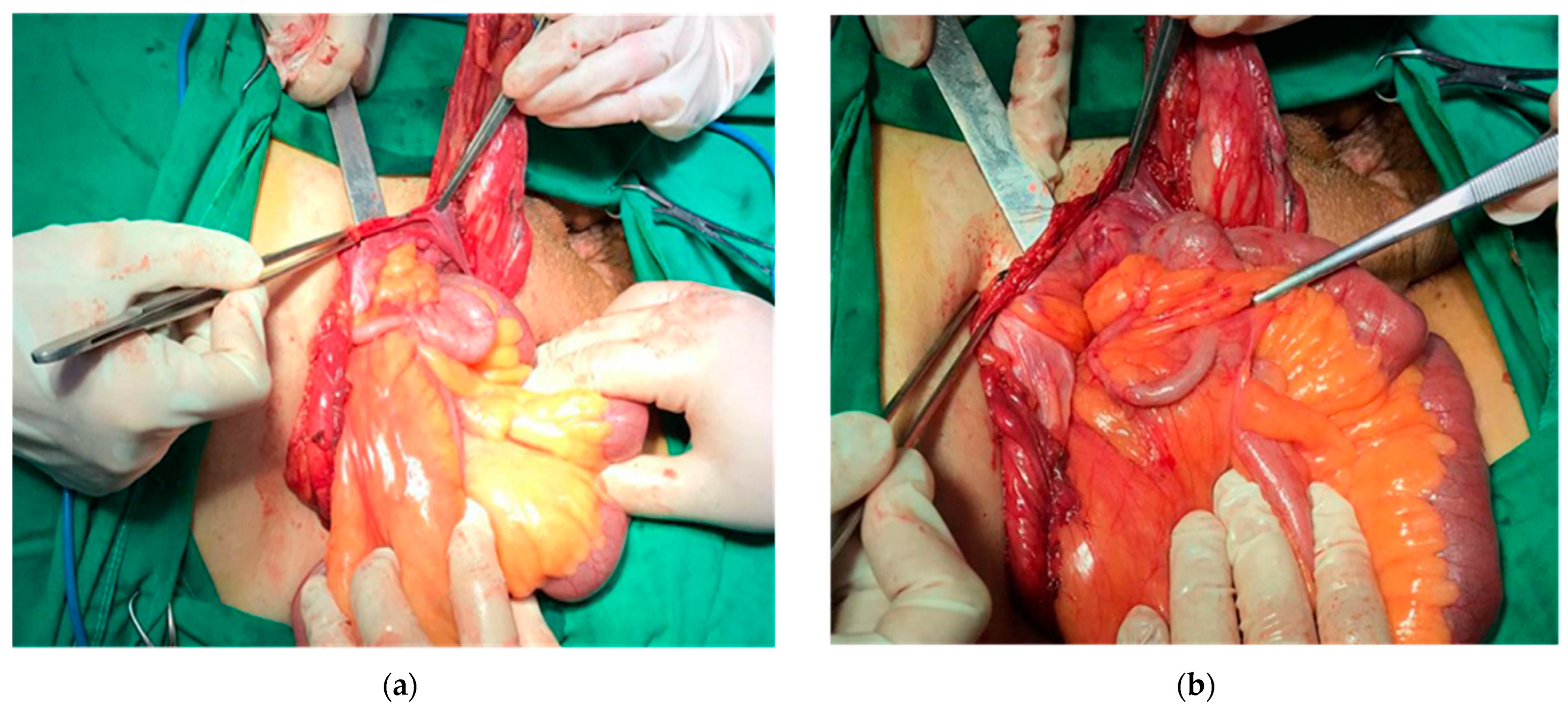 Diagnostics 13 03534 g001