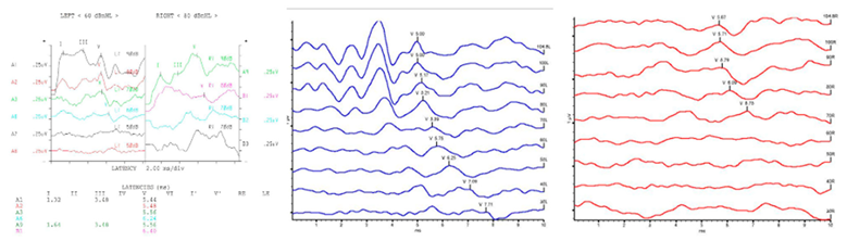 Diagnostics 13 03538 i001 Diagnostics 13 03538 i001