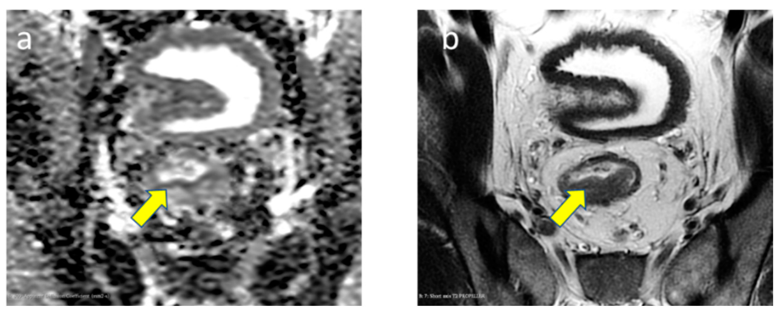 Diagnostics 13 03541 g001 Diagnostics 13 03541 g001