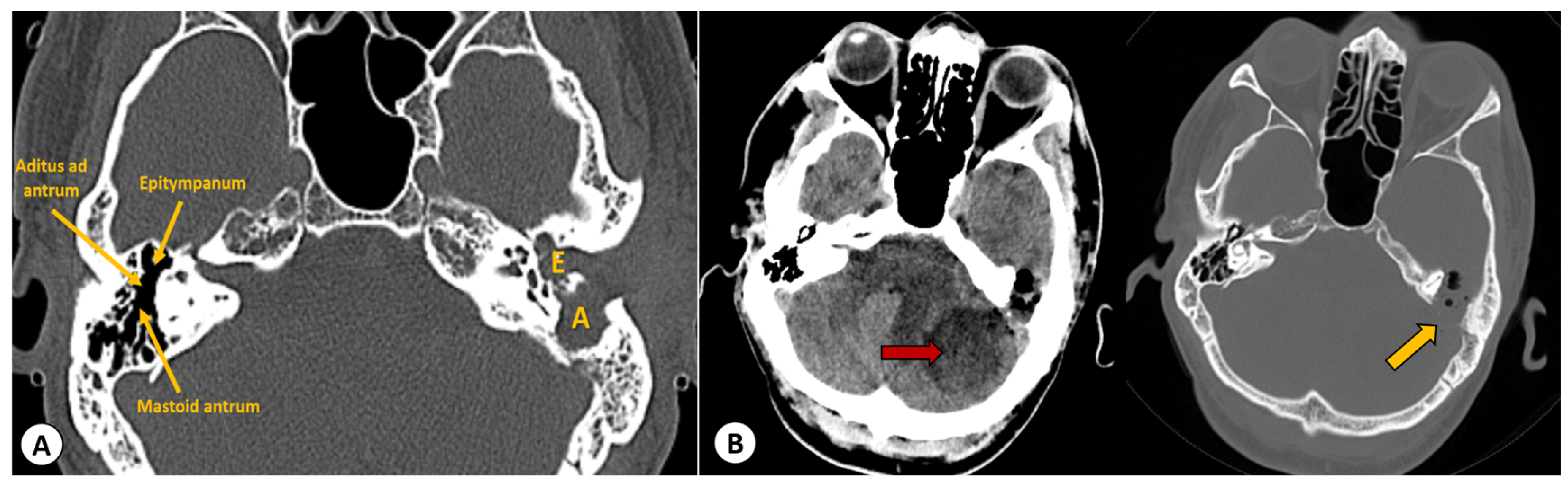 Diagnostics 13 03566 g001