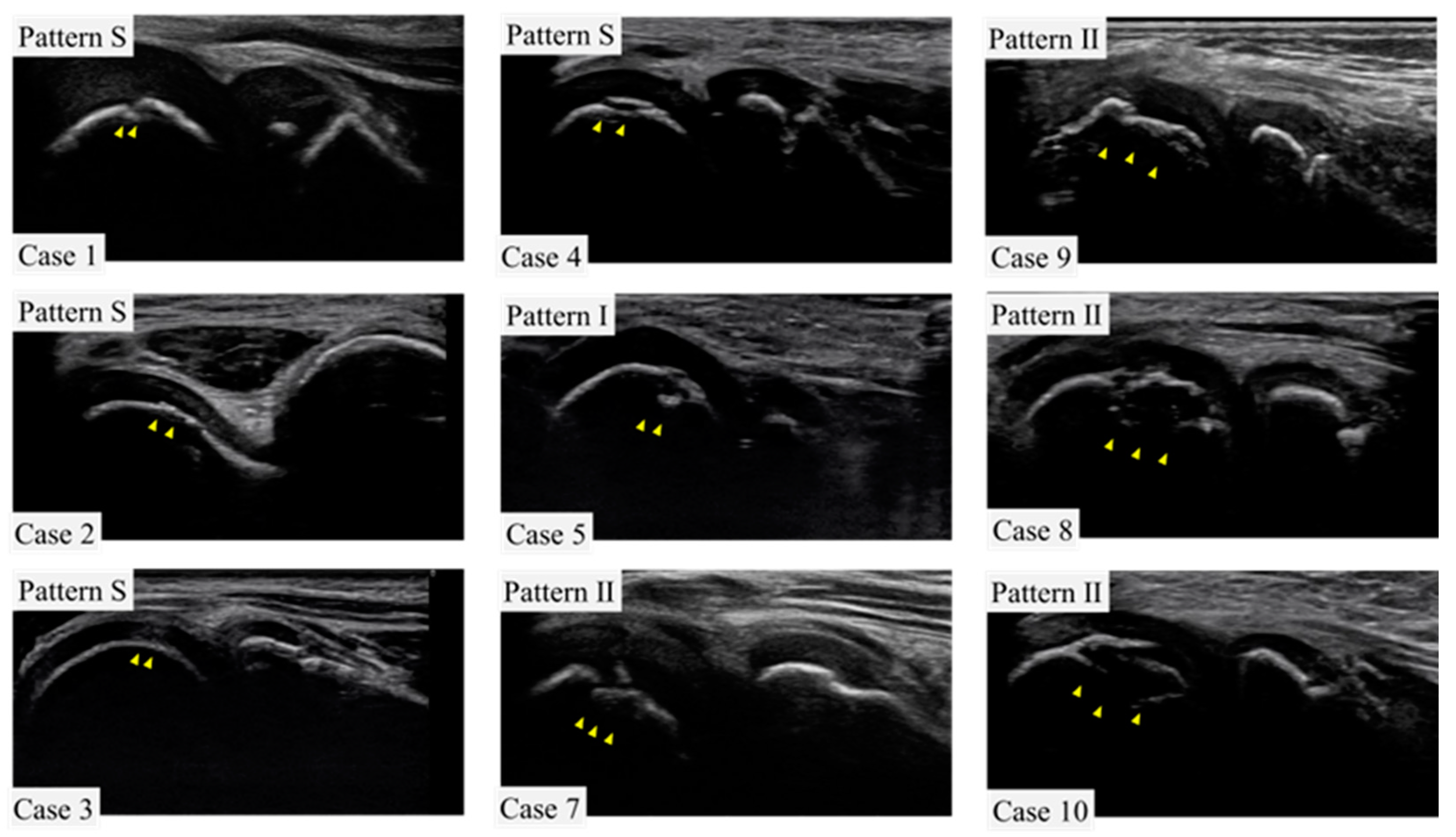 Diagnostics 13 03589 g004