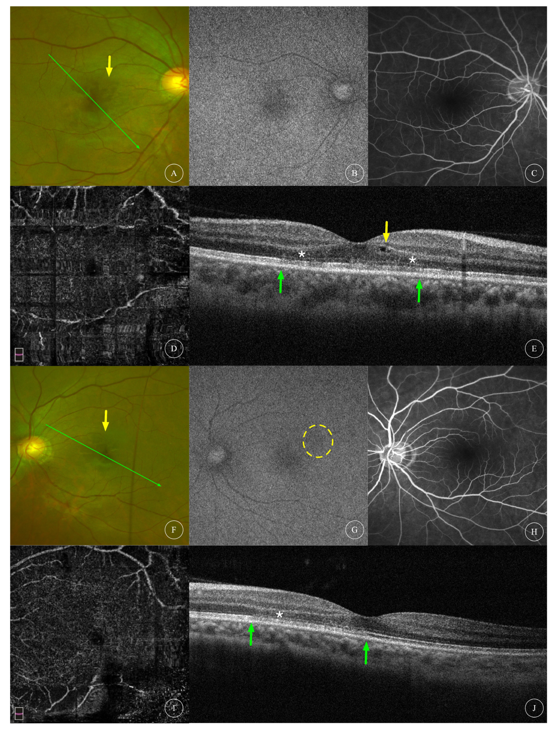 Diagnostics 13 03600 g004