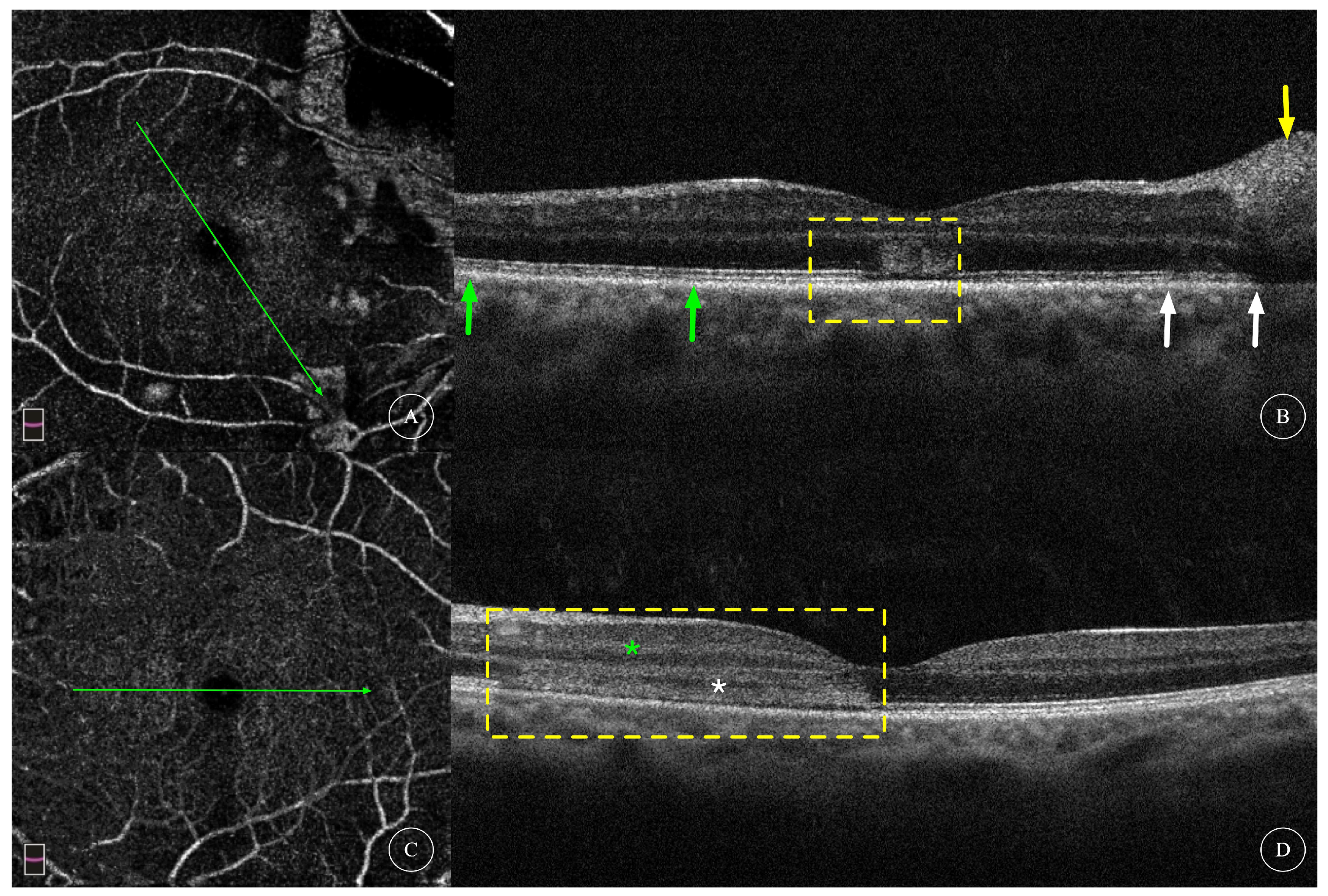 Diagnostics 13 03600 g005