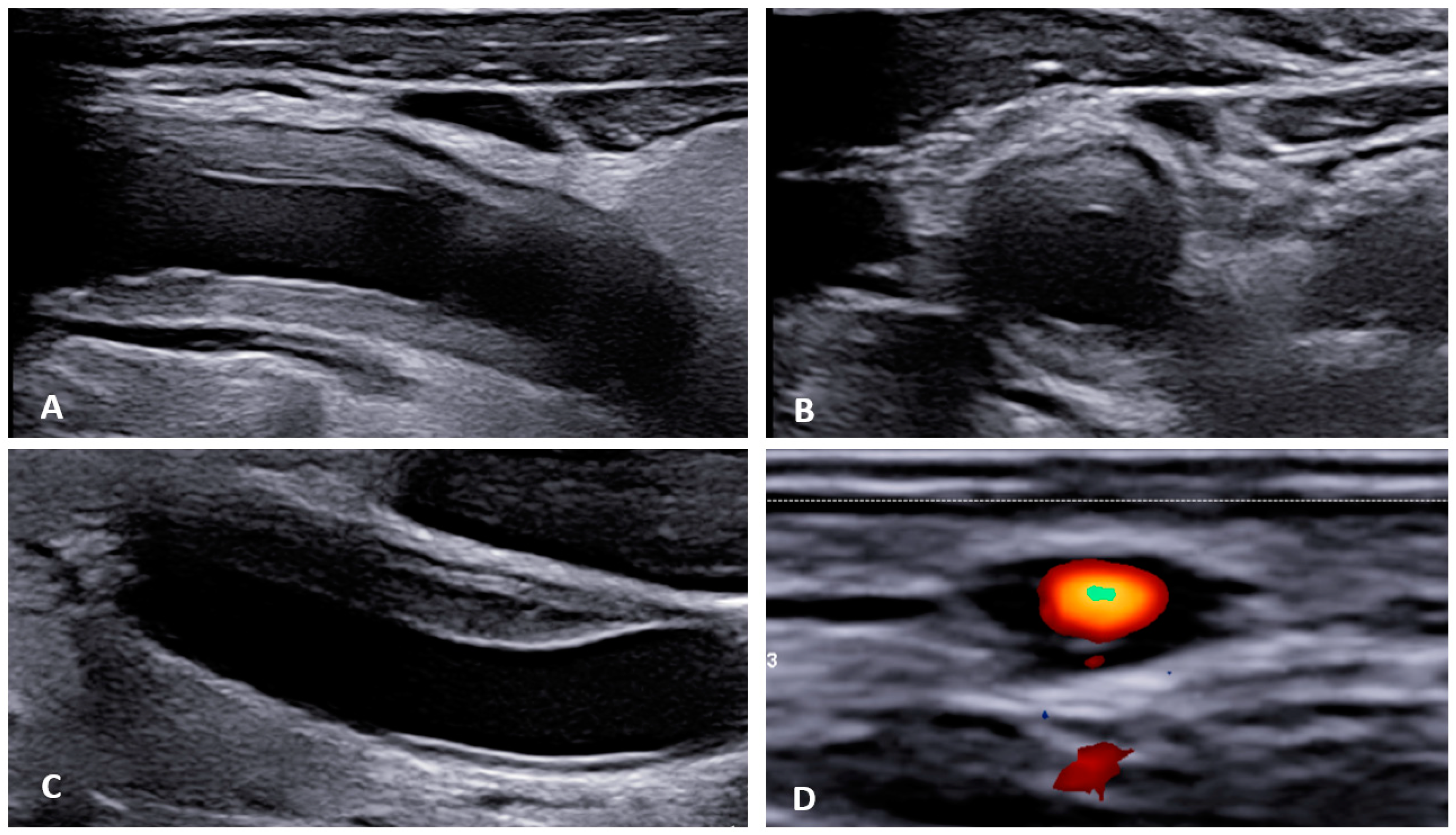 Diagnostics 13 03603 g002