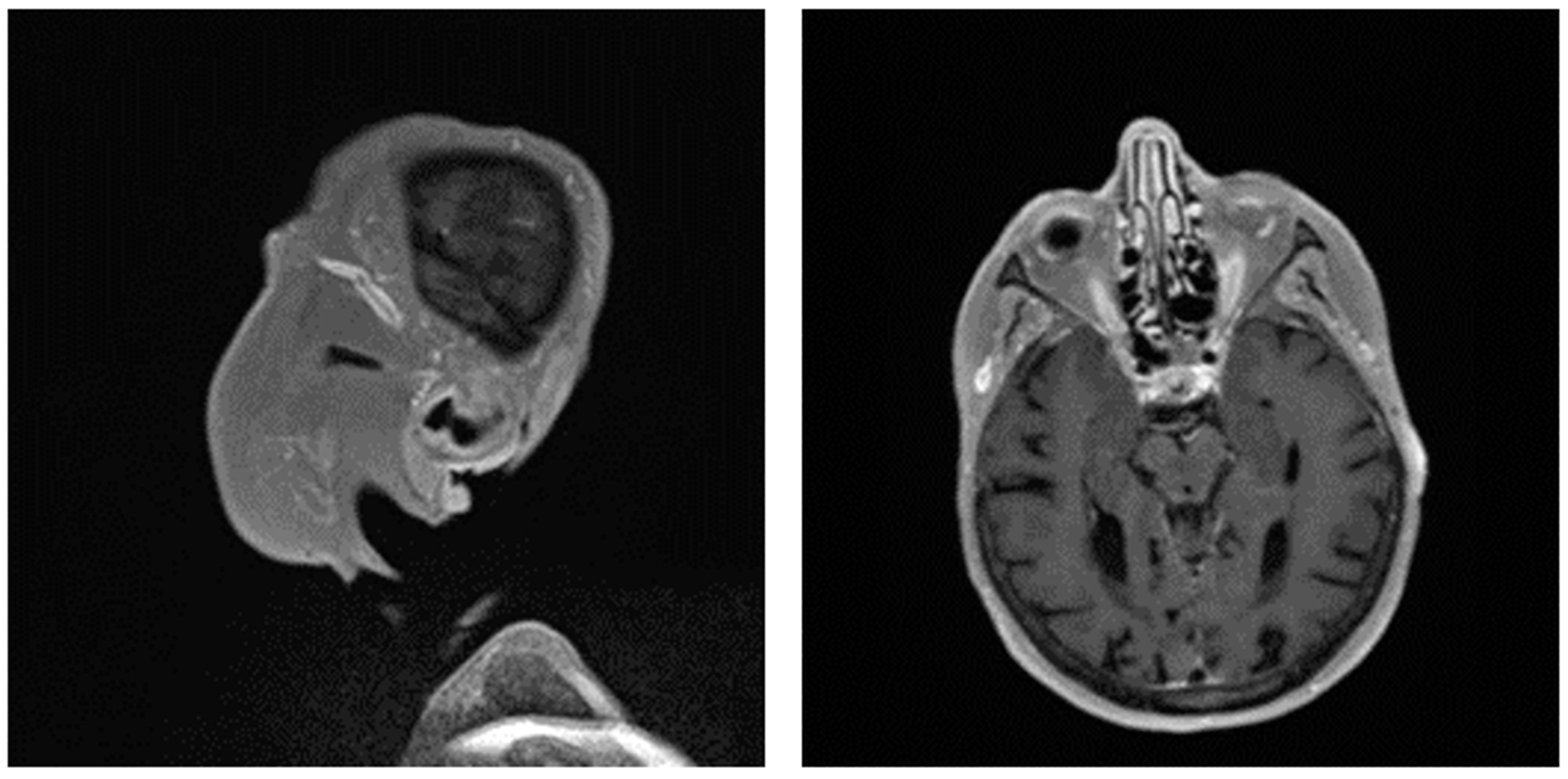 Diagnostics 13 03603 g004