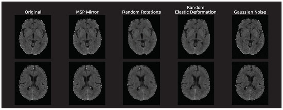 Diagnostics 13 03604 g0a2