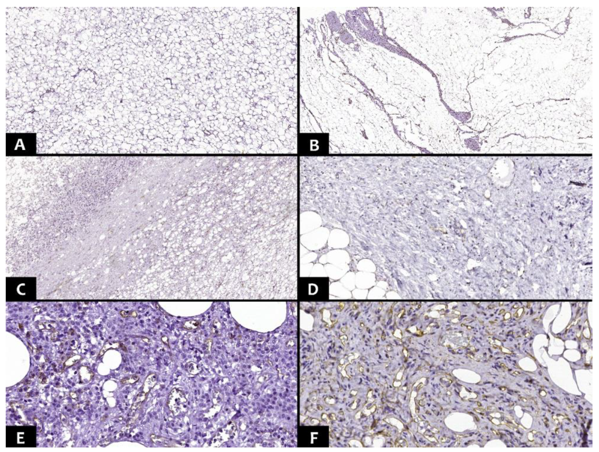 Diagnostics 13 03606 g004