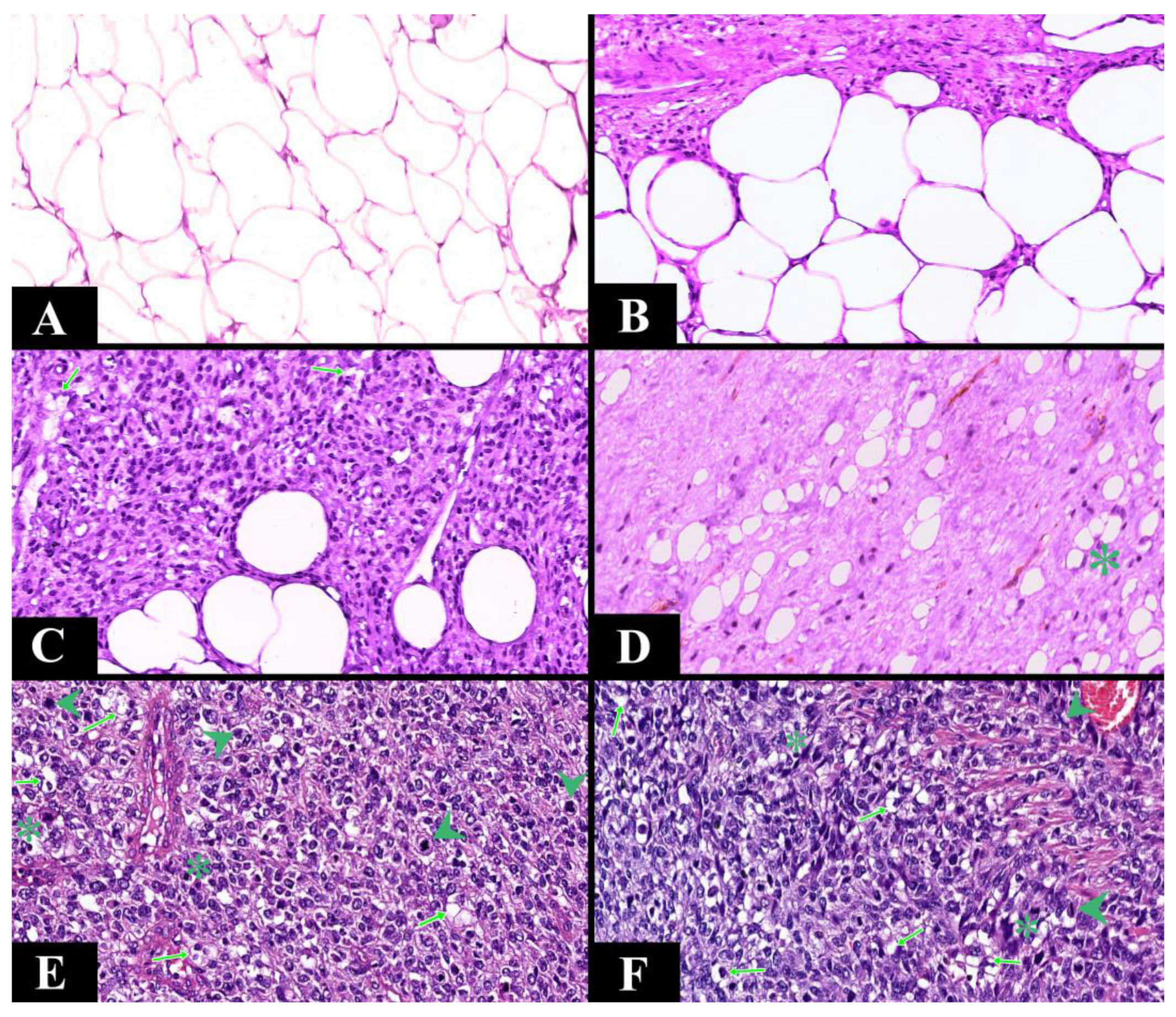 Diagnostics 13 03606 g006