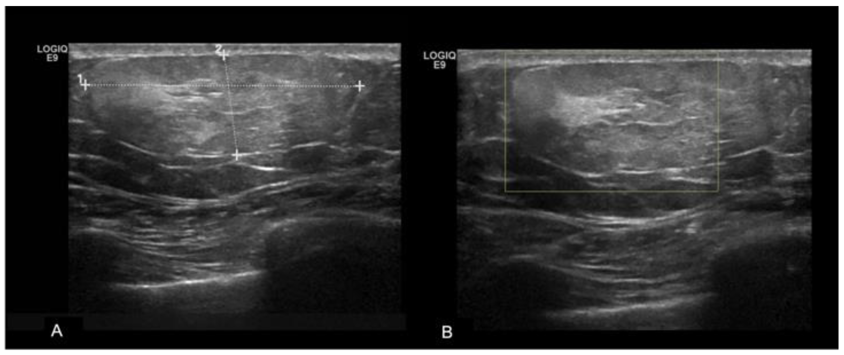 Diagnostics 13 03620 g003