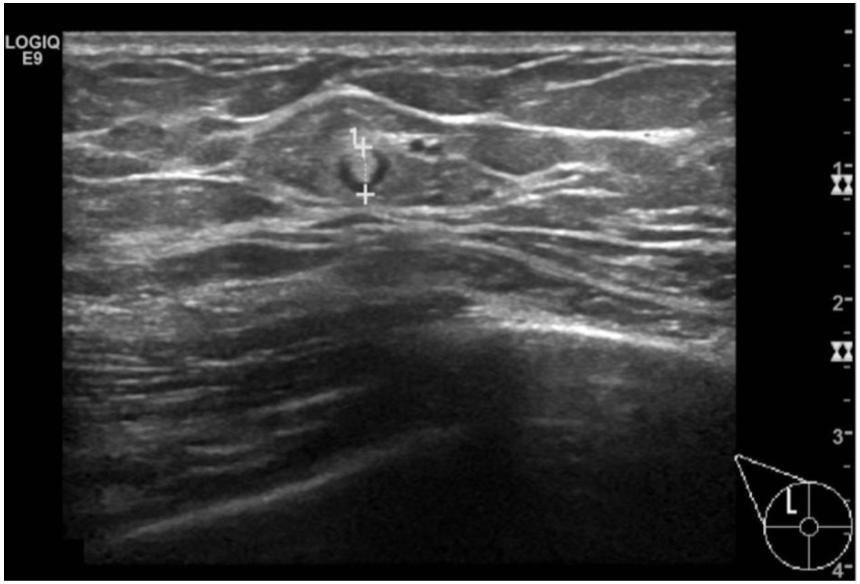 Diagnostics 13 03620 g006