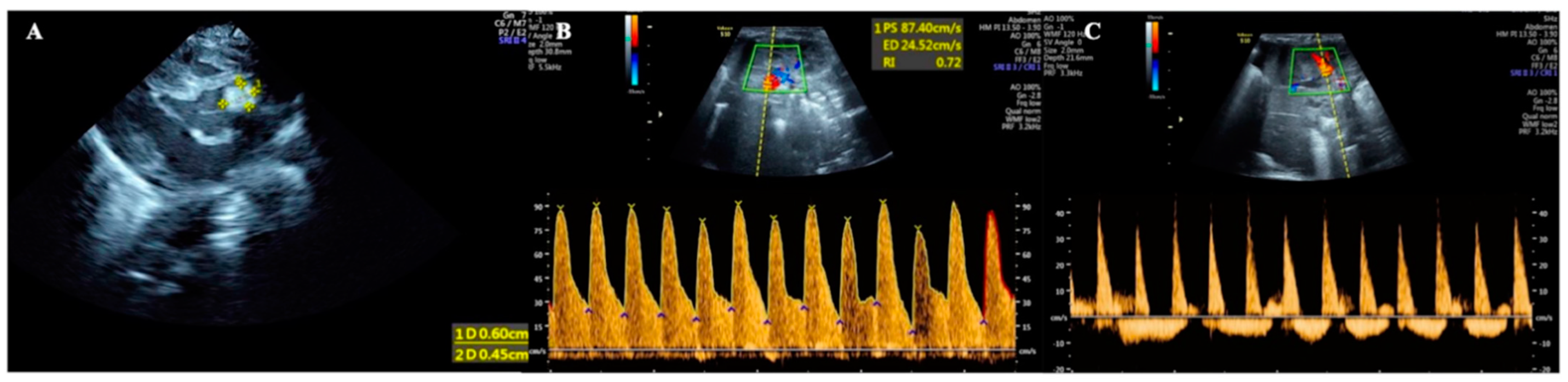 Diagnostics 13 03624 g001