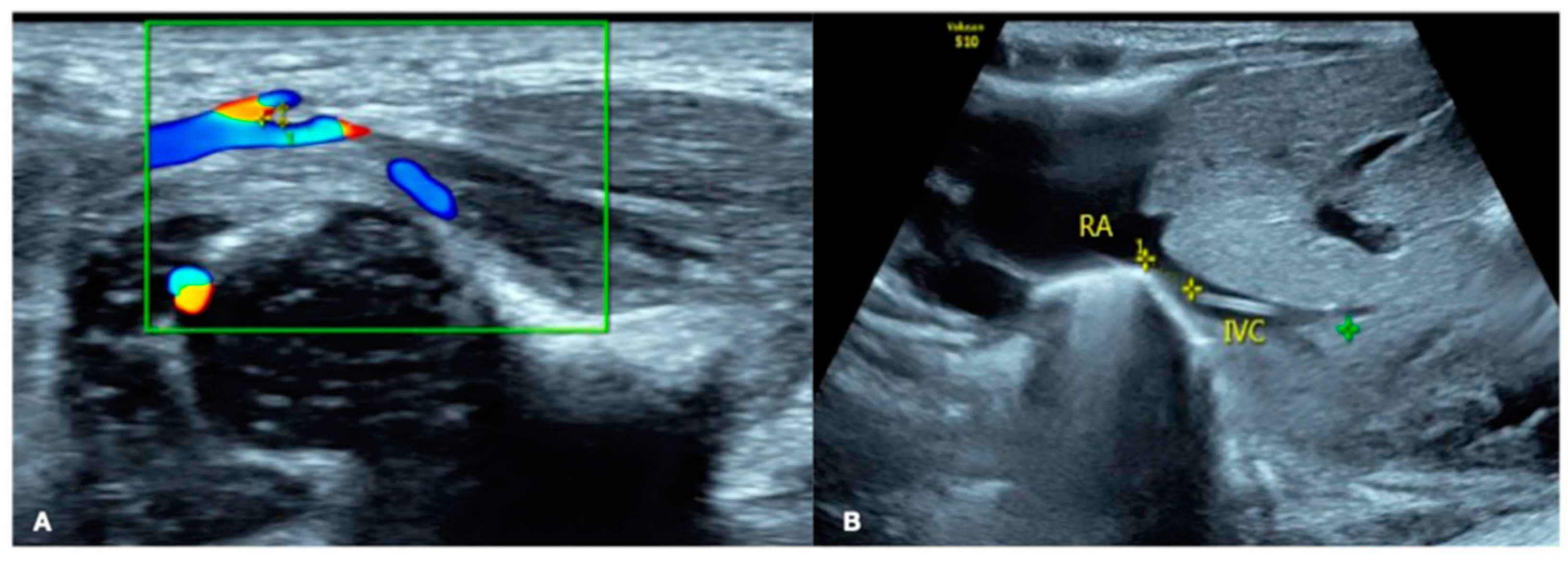 Diagnostics 13 03624 g004