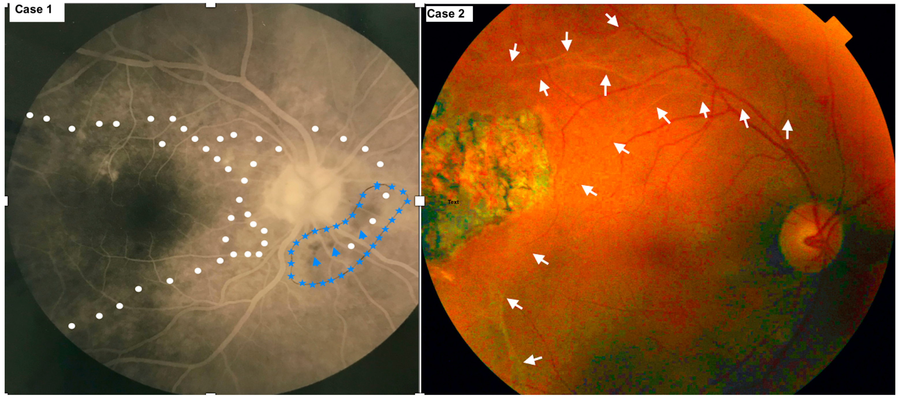 Diagnostics 13 03626 g001