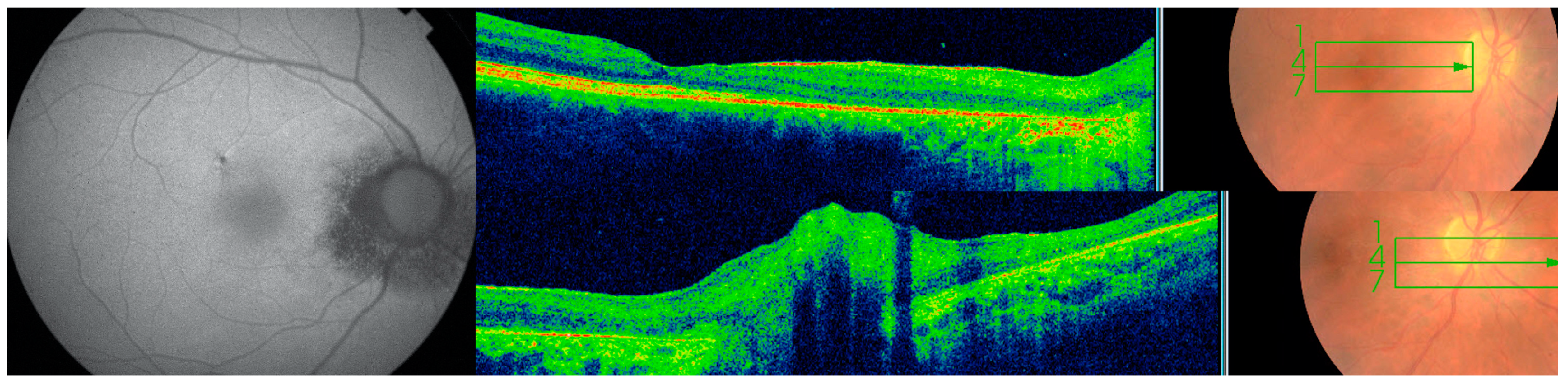 Diagnostics 13 03626 g005