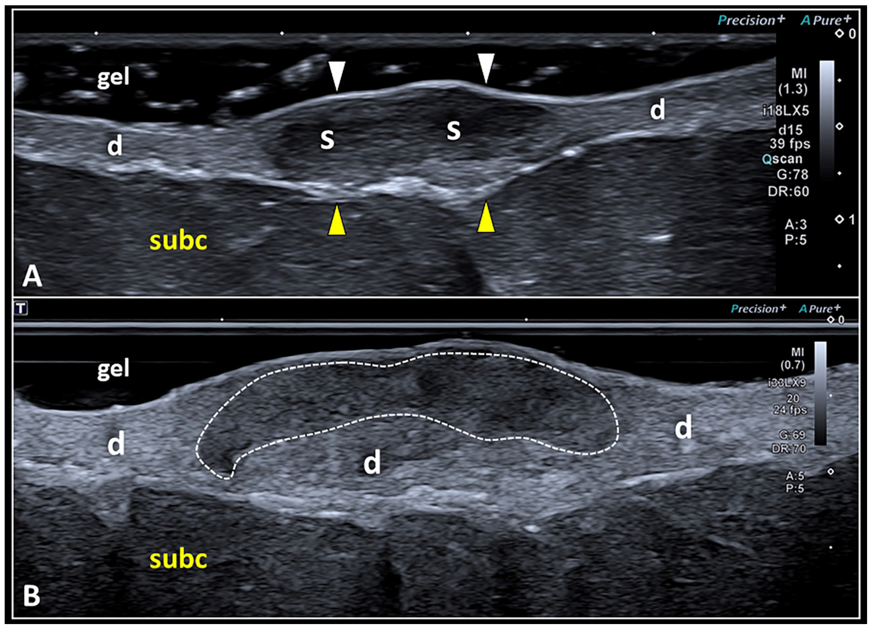Diagnostics 13 03629 g005