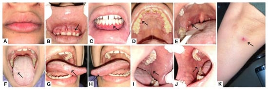 Diagnostics 13 03633 g001