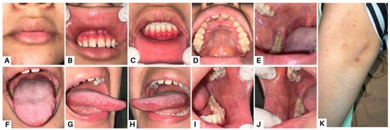 Diagnostics 13 03633 g002