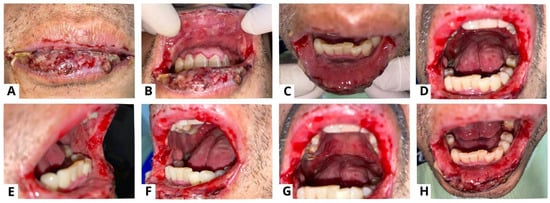 Diagnostics 13 03633 g003