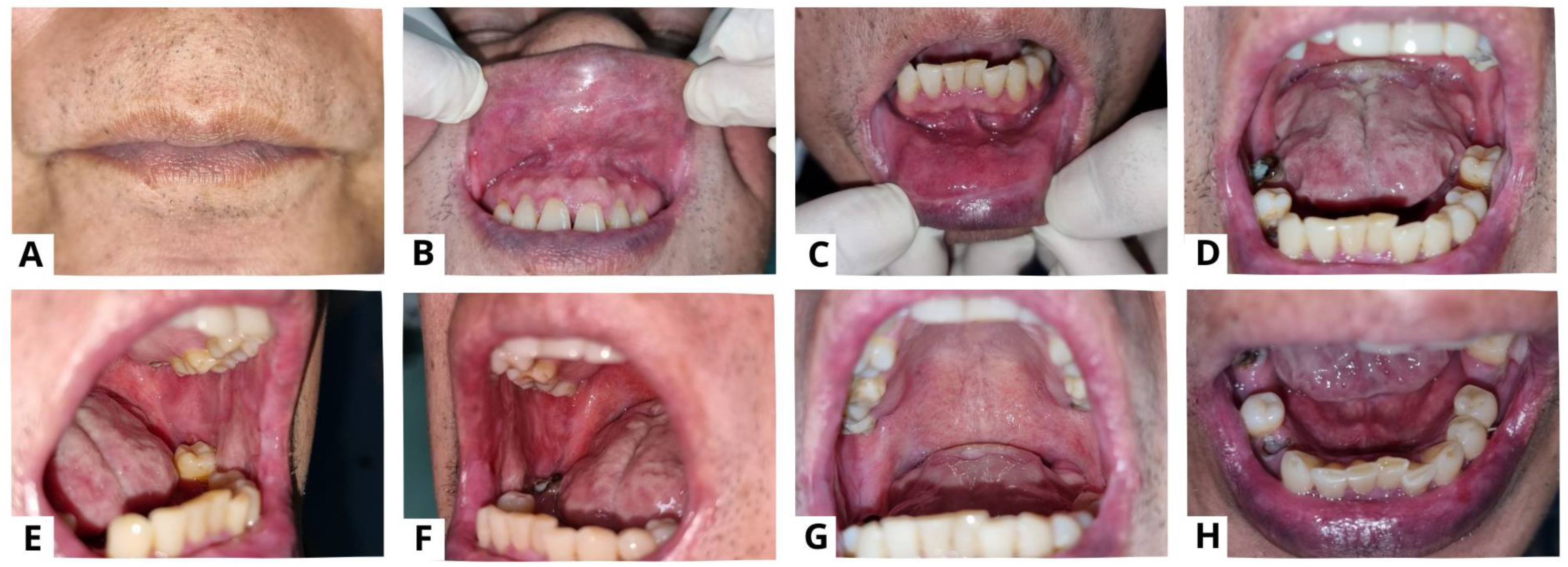 Diagnostics 13 03633 g004