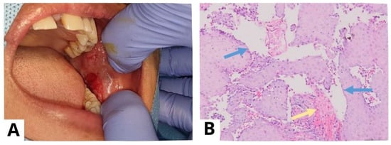 Diagnostics 13 03633 g007