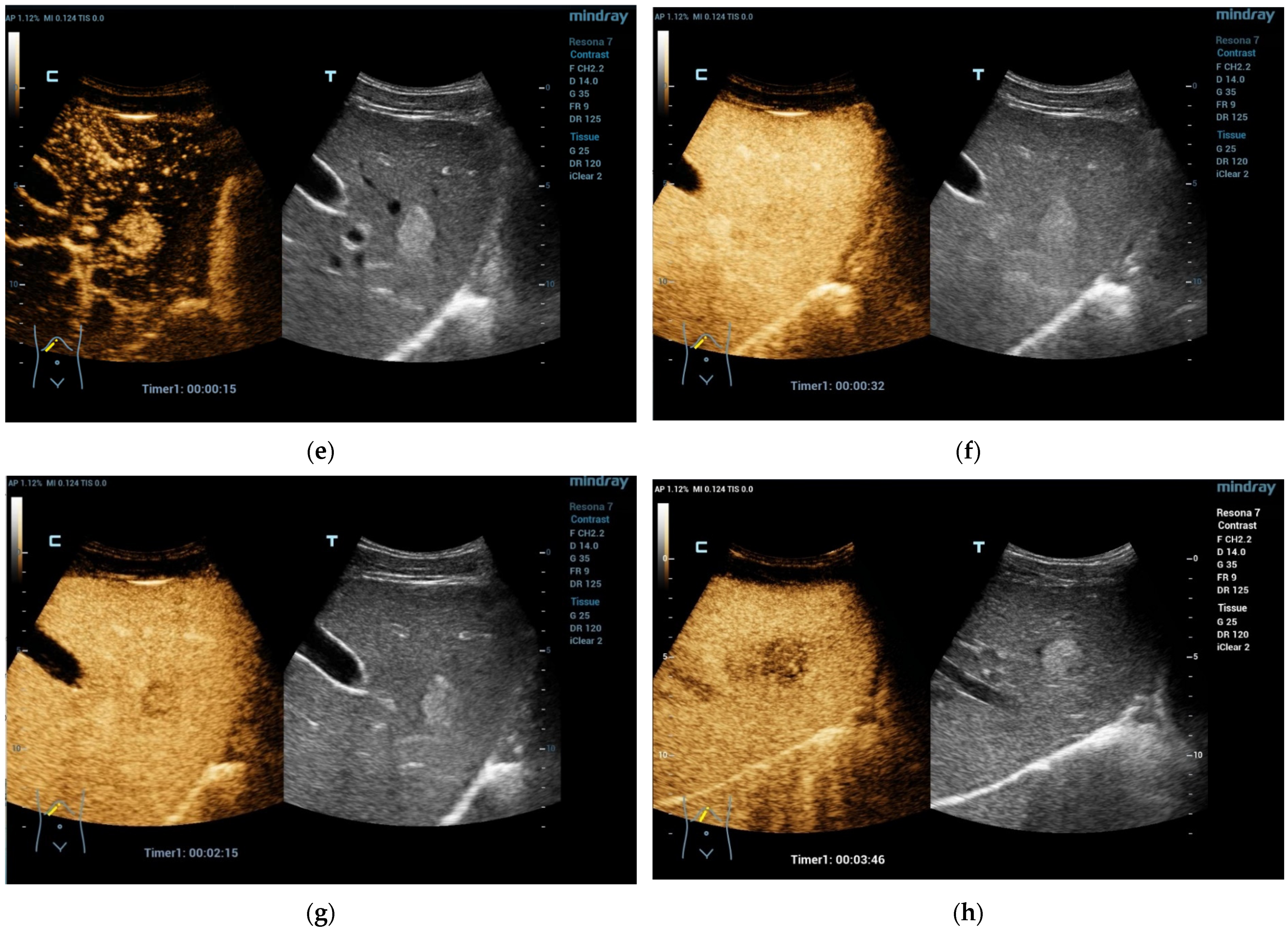 Diagnostics 13 03659 g001b