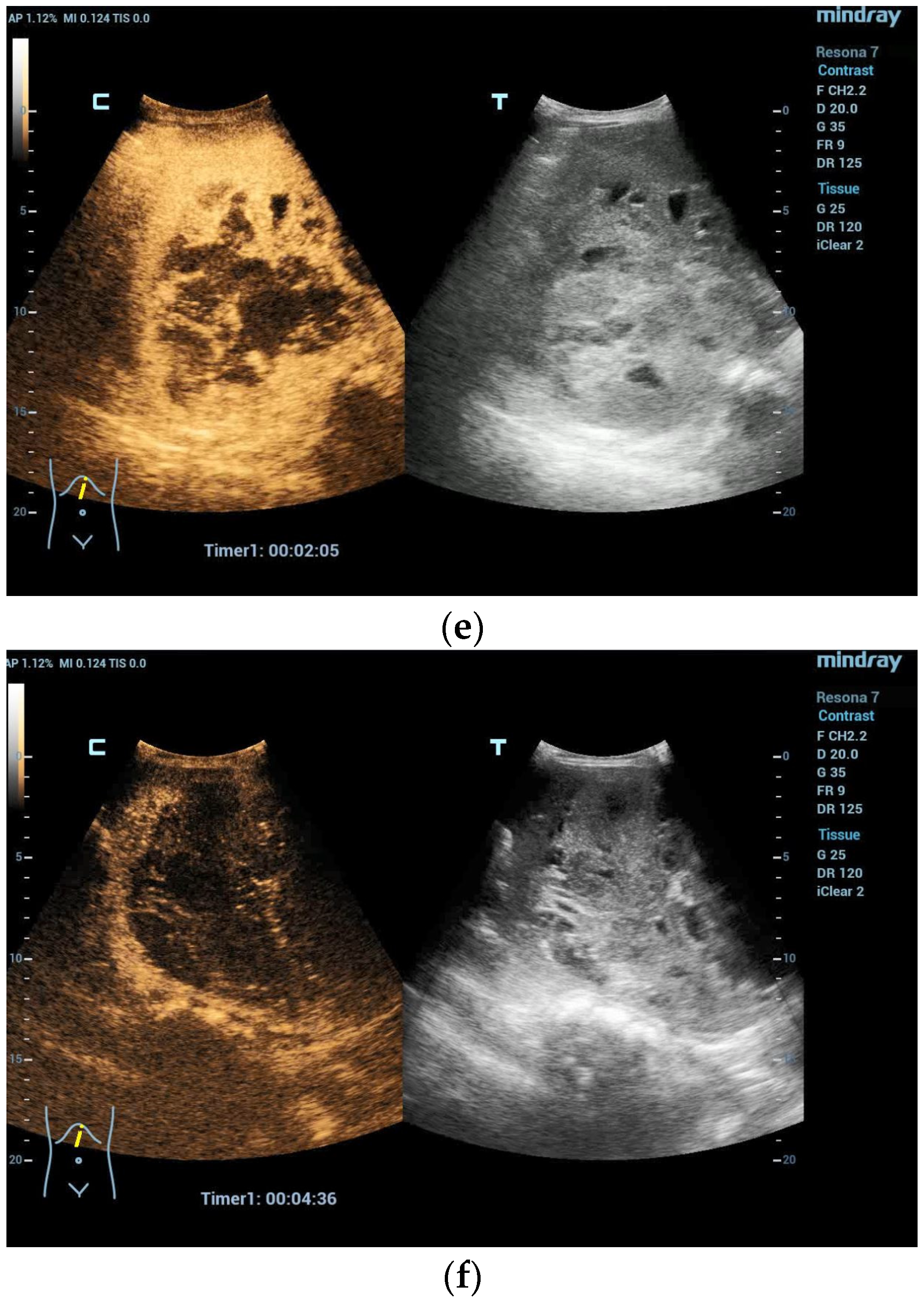 Diagnostics 13 03659 g002b