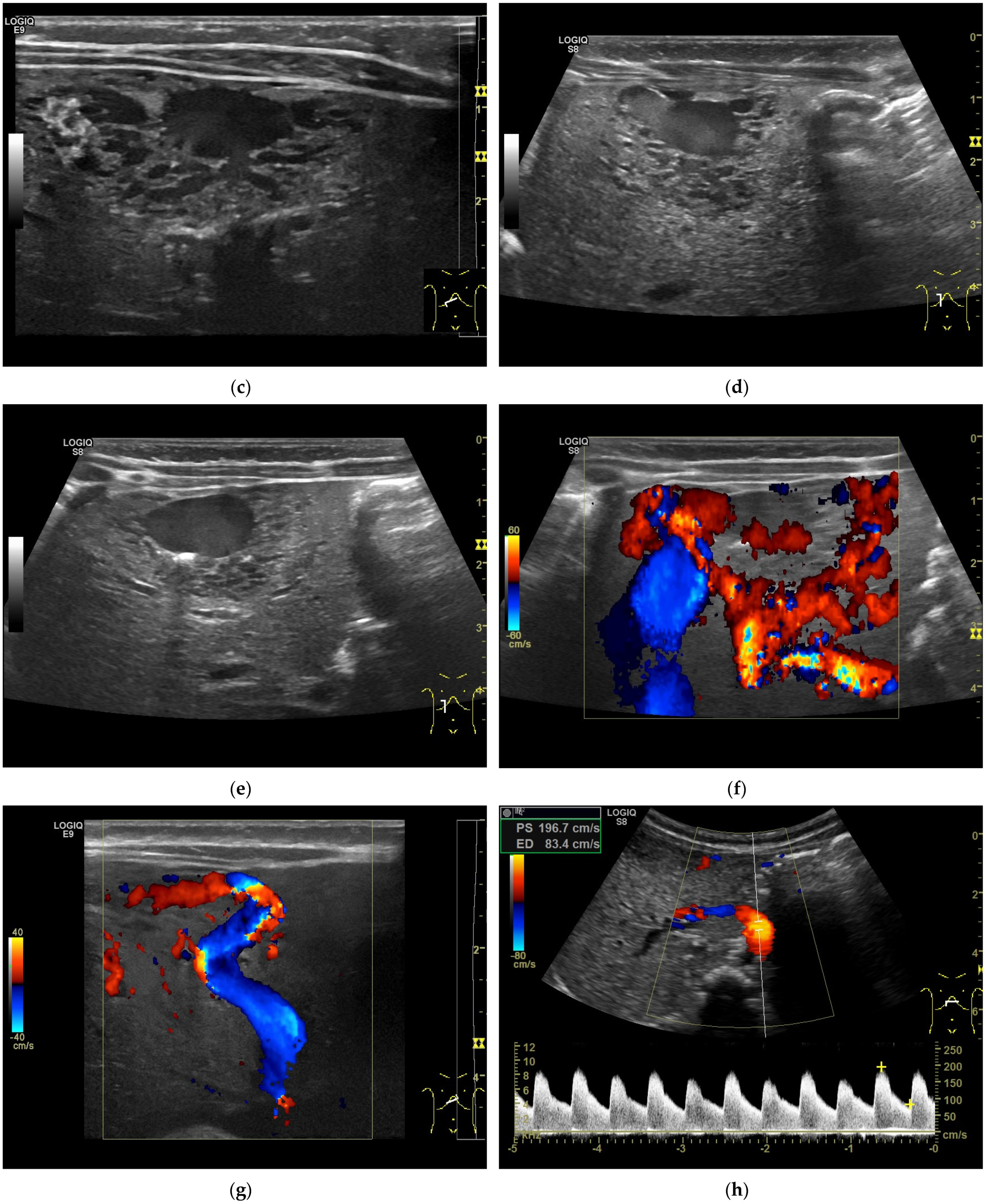 Diagnostics 13 03659 g003b