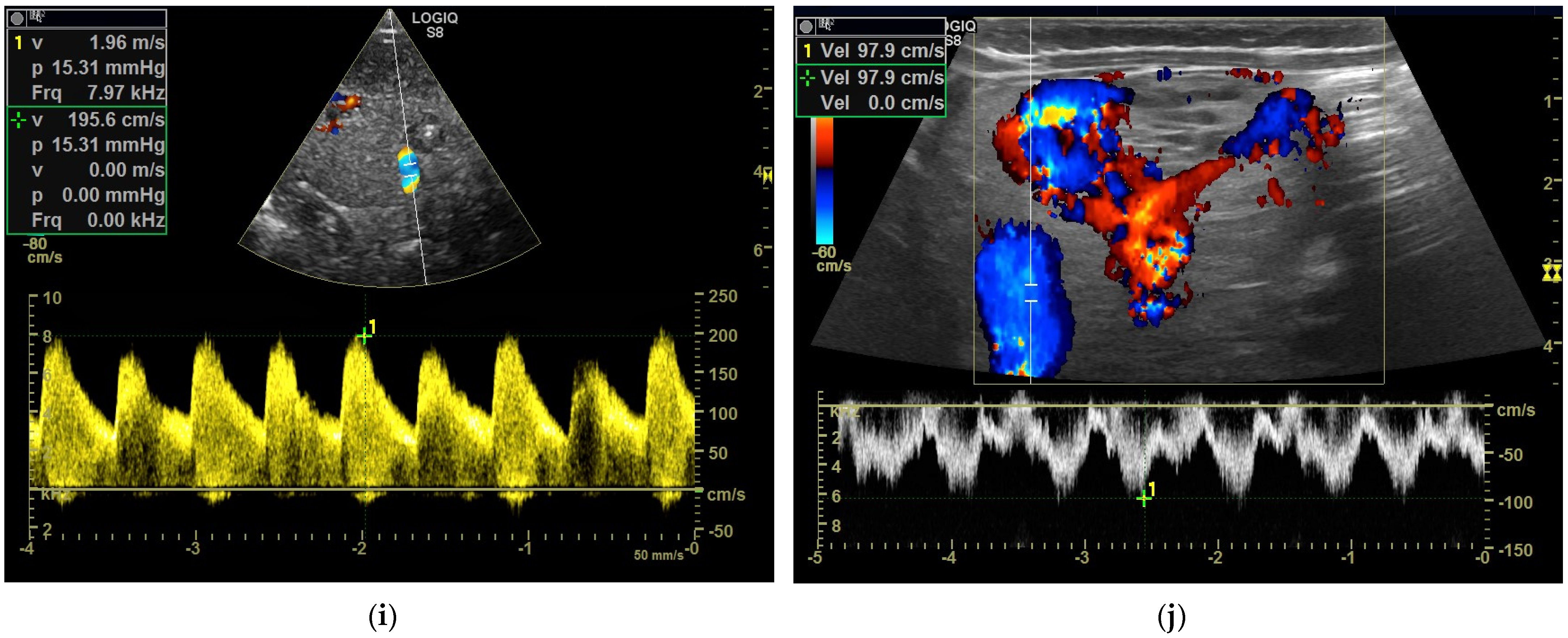 Diagnostics 13 03659 g003c