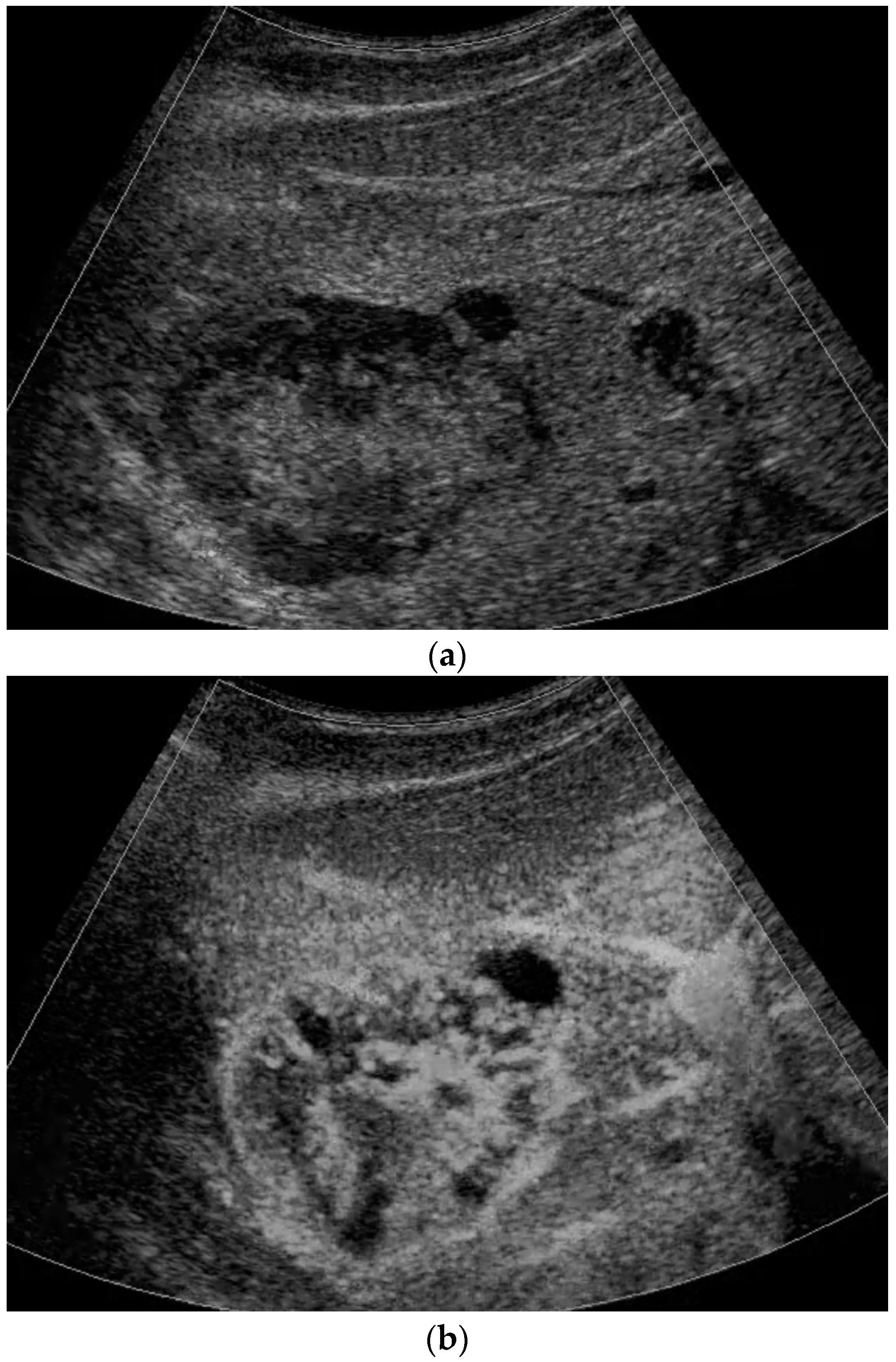 Diagnostics 13 03659 g004a
