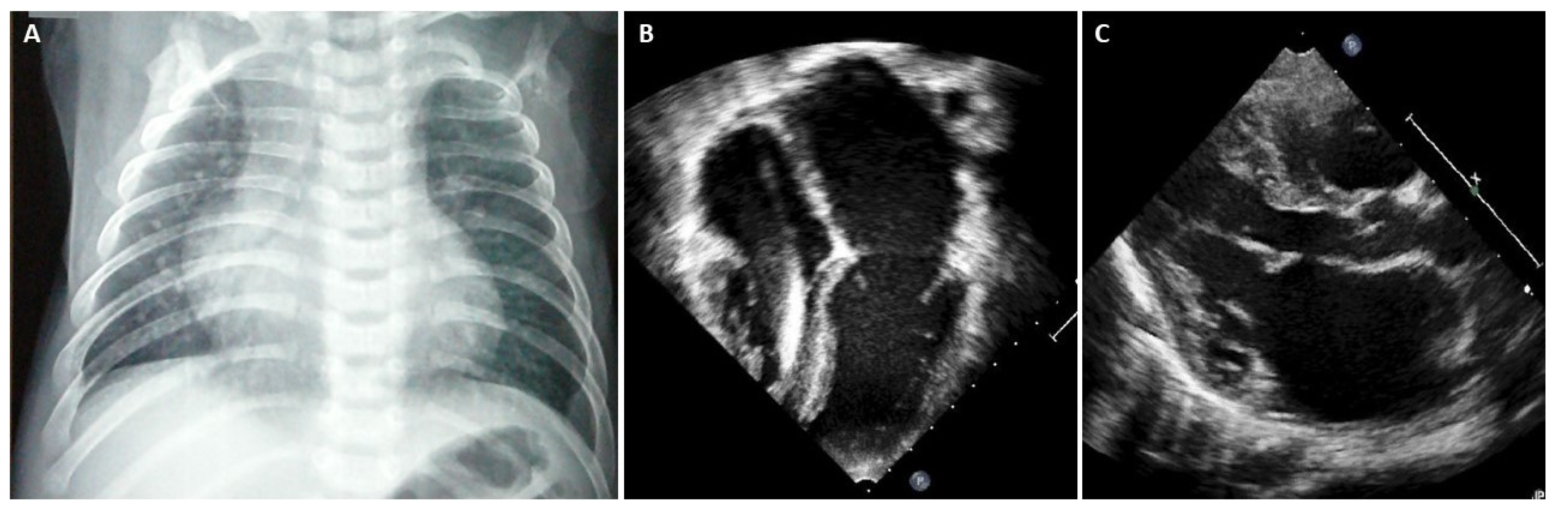Diagnostics 13 03666 g003 Diagnostics 13 03666 g003