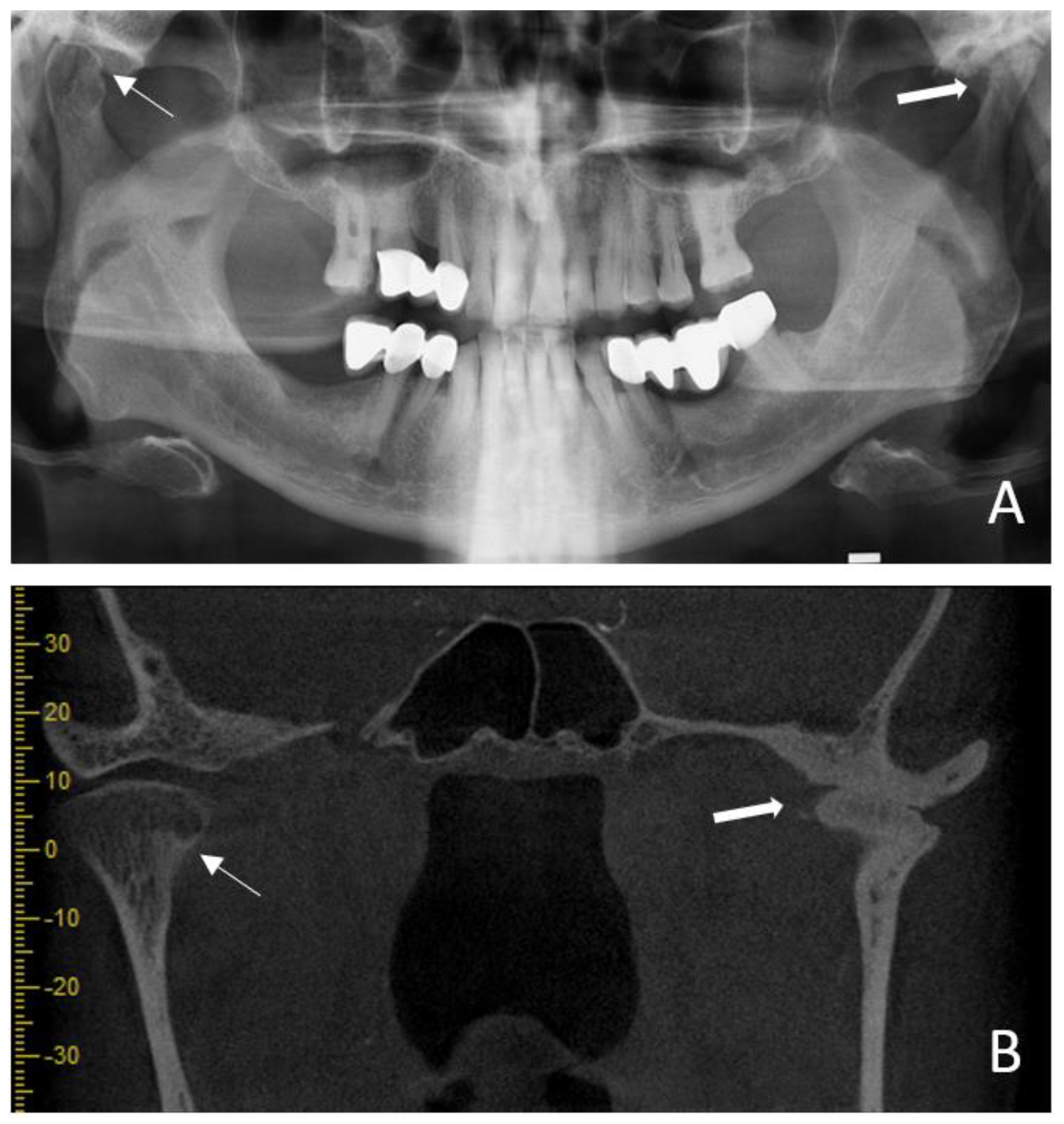 Diagnostics 14 00004 g003