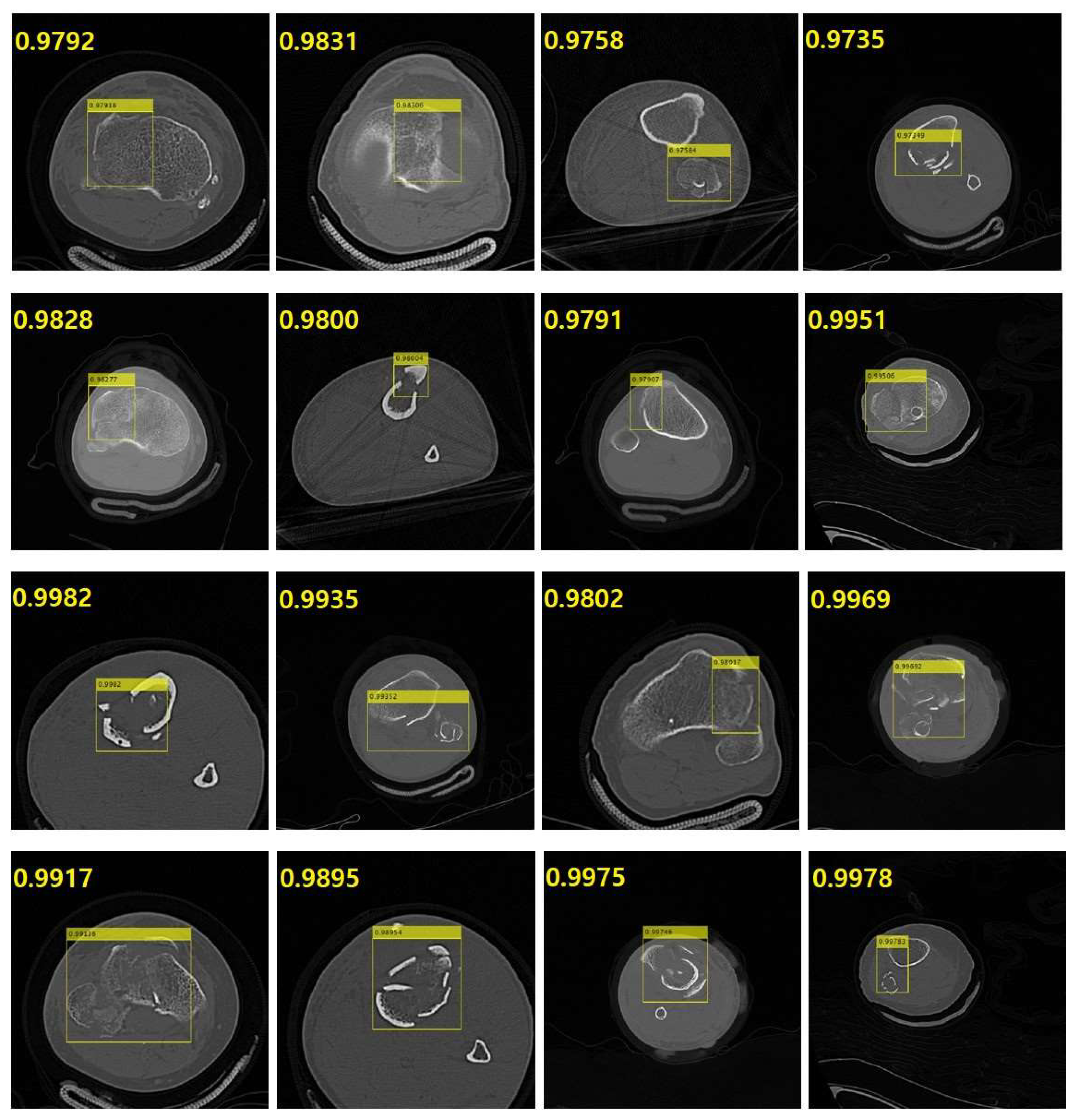 Diagnostics 14 00011 g007