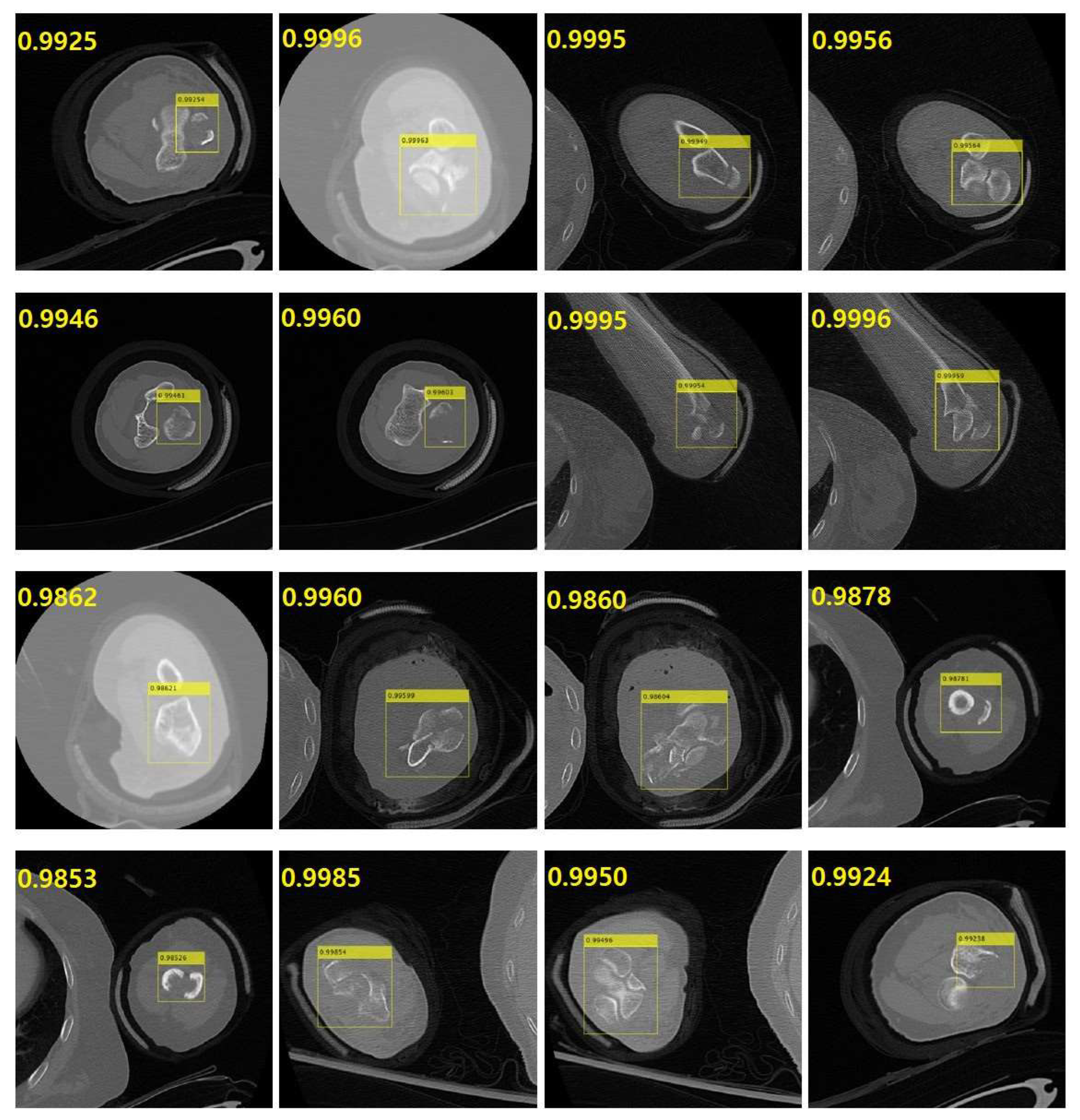 Diagnostics 14 00011 g008