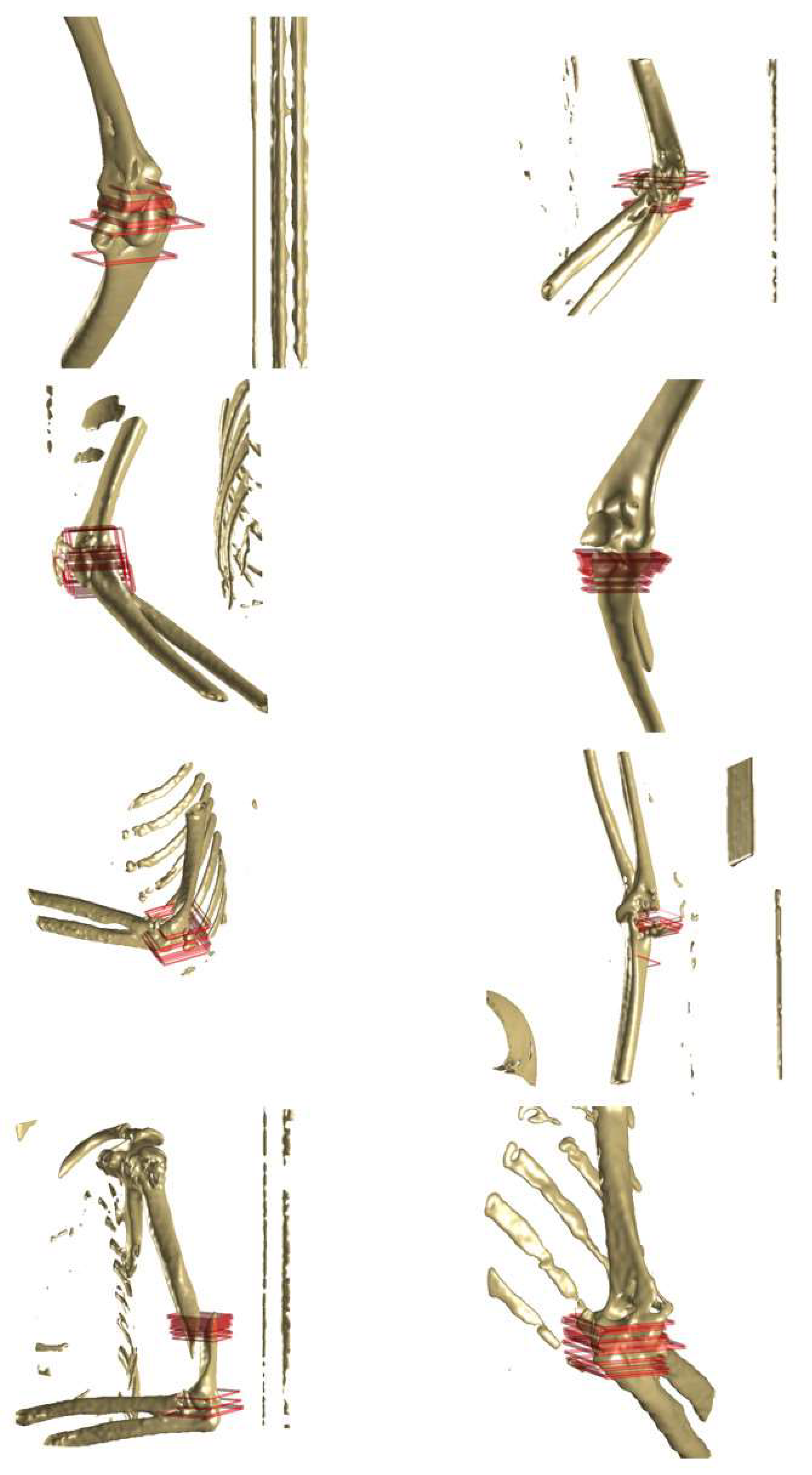 Diagnostics 14 00011 g010