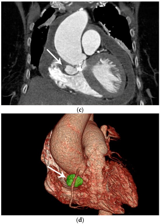 Diagnostics 14 00019 g001b