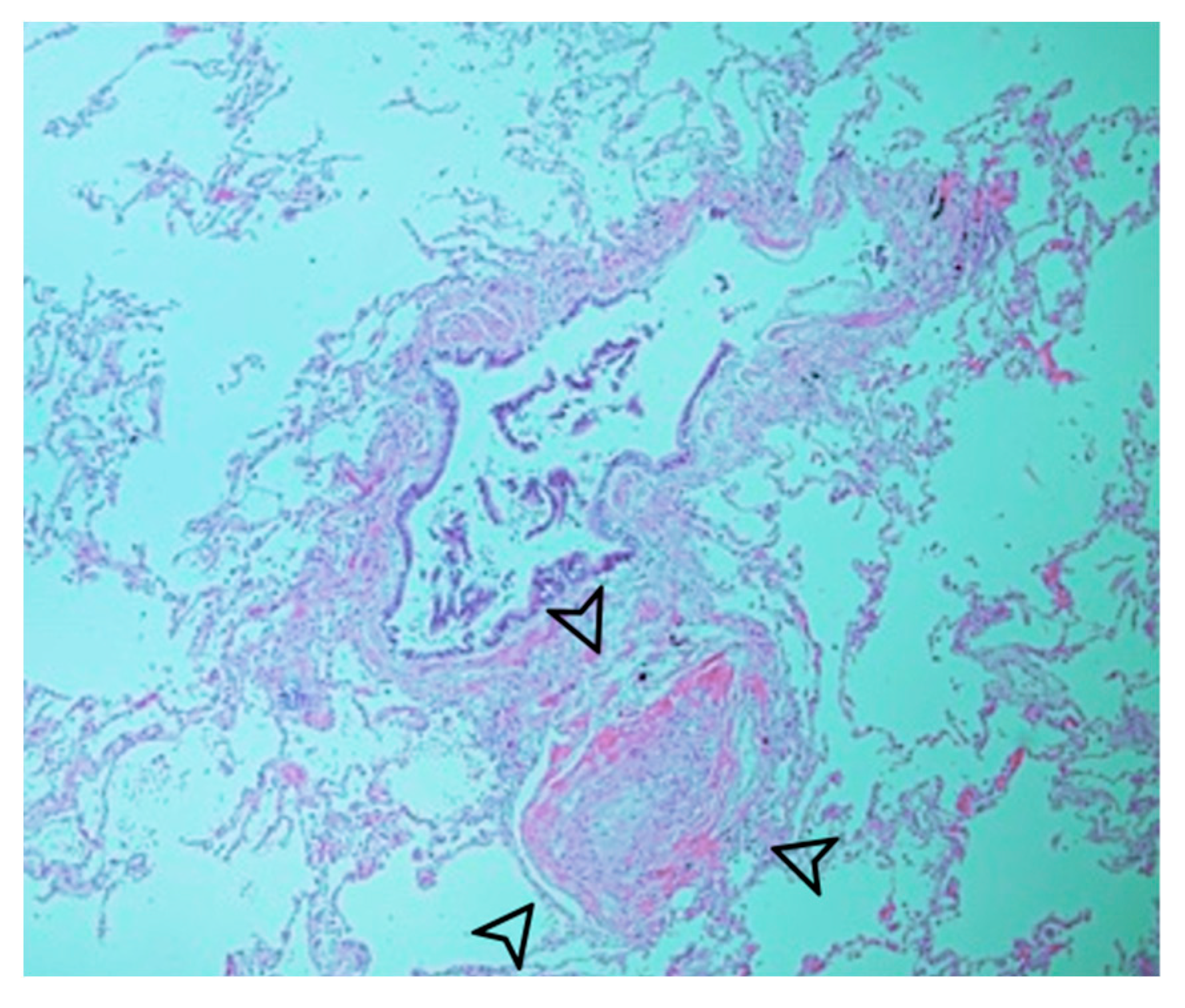 Diagnostics 14 00032 g003