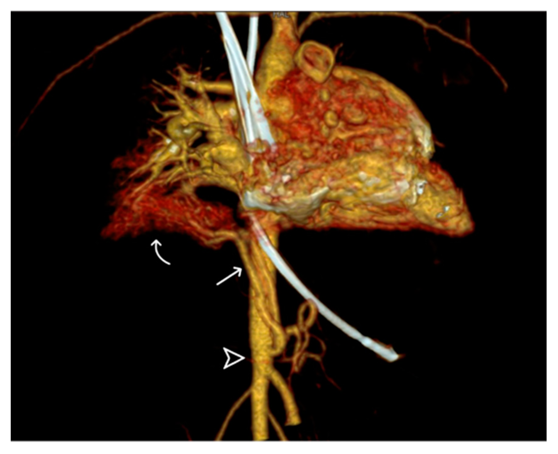 Diagnostics 14 00032 g005