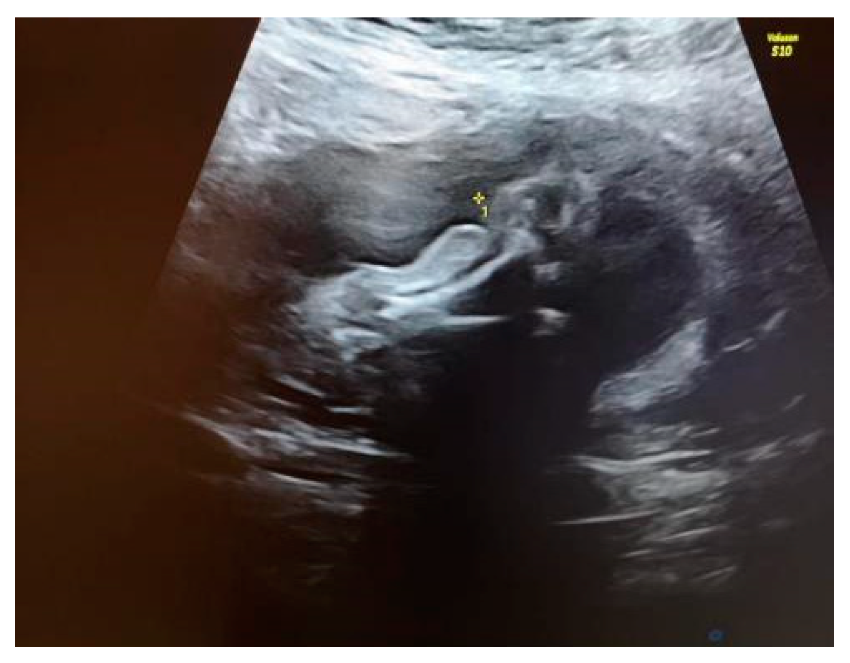 Diagnostics 14 00034 g002