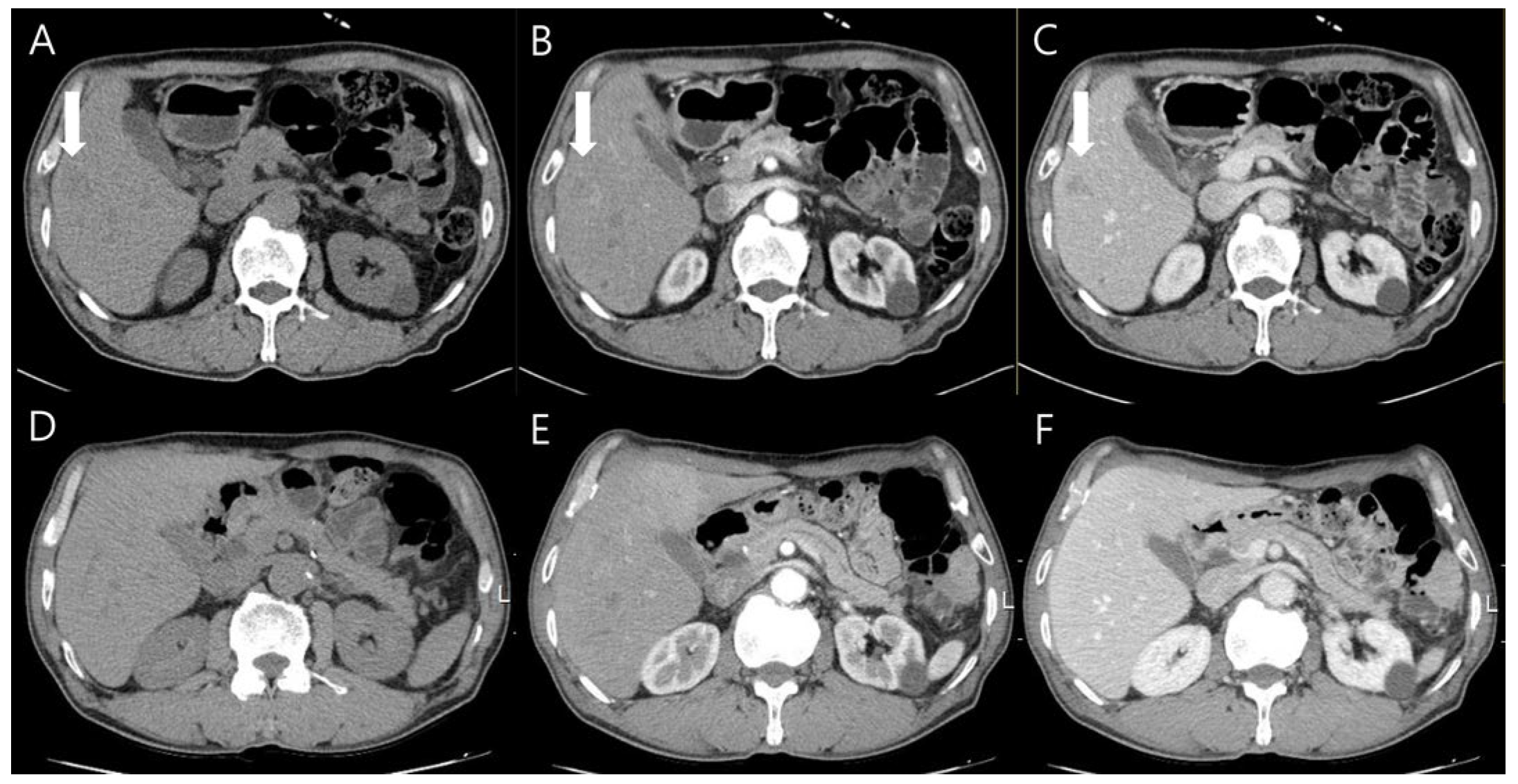 Diagnostics 14 00058 g003 Diagnostics 14 00058 g003