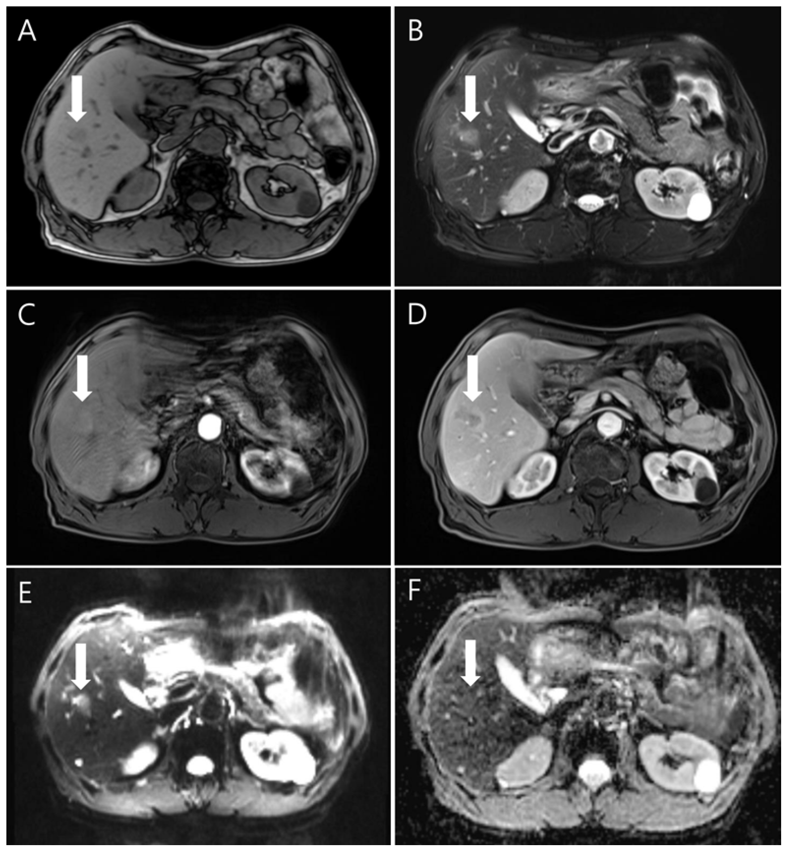 Diagnostics 14 00058 g004 Diagnostics 14 00058 g004