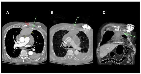 Diagnostics 14 00063 g001