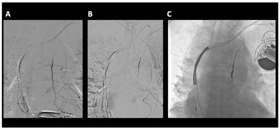 Diagnostics 14 00063 g002