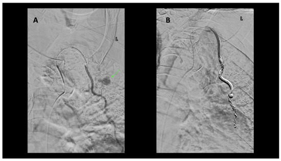Diagnostics 14 00063 g004
