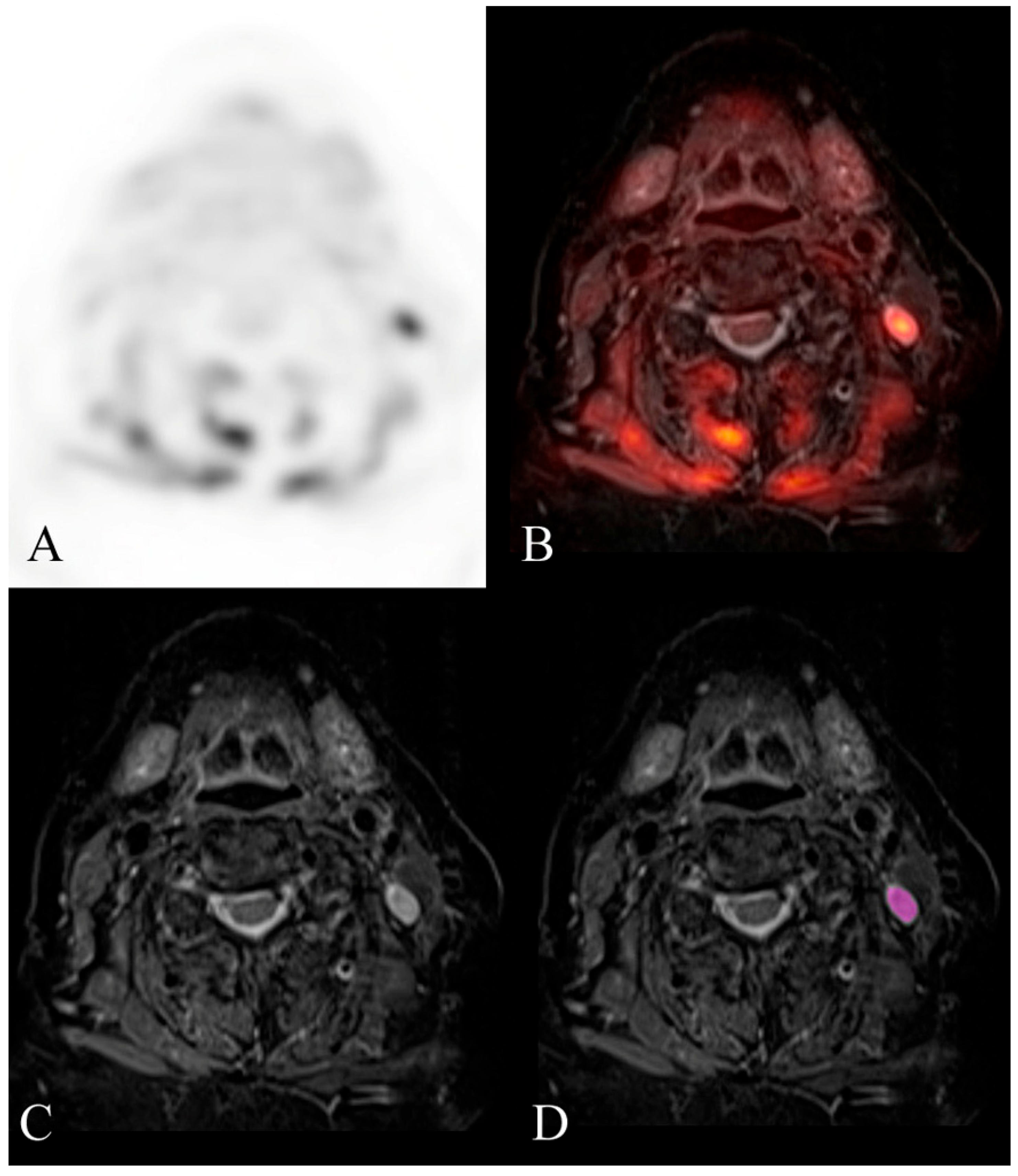 Diagnostics 14 00071 g004